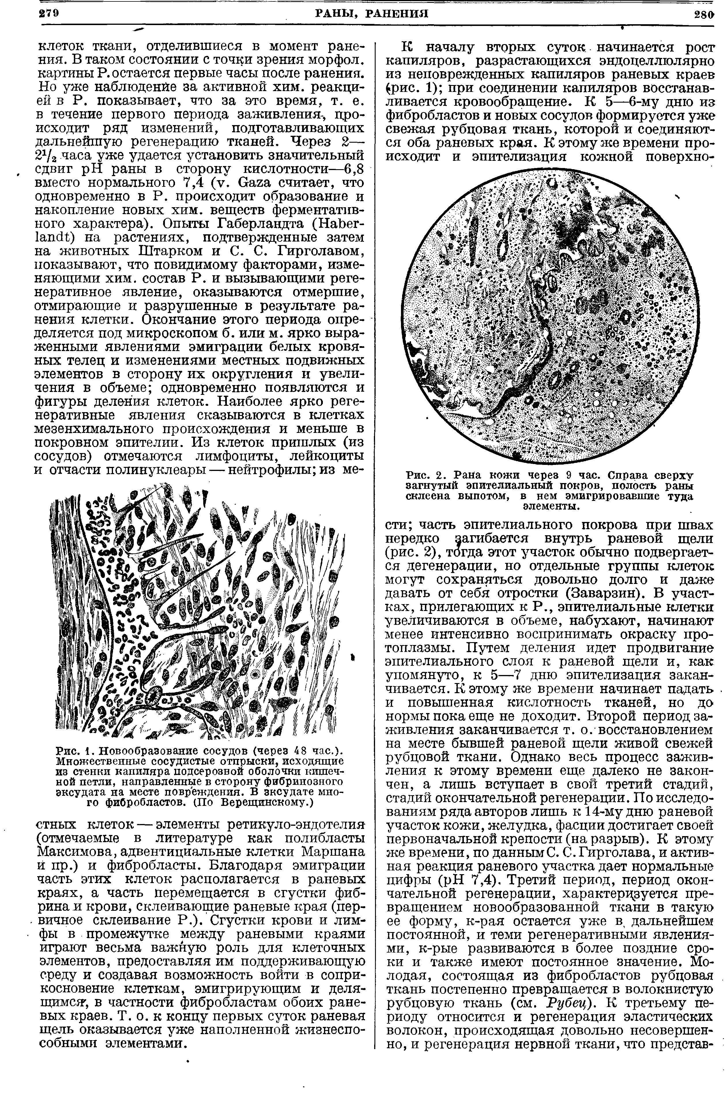 Рис. 1. Новообразование сосудов (через 48 час.). Множественные сосудистые отпрыски, исходящие из стенки капипяра подсерозной оболочки кишечной петли, направленные в сторону фибринозного эксудата на месте повреждения. В зксудате много фибробластов. (По Верещинскому.)...