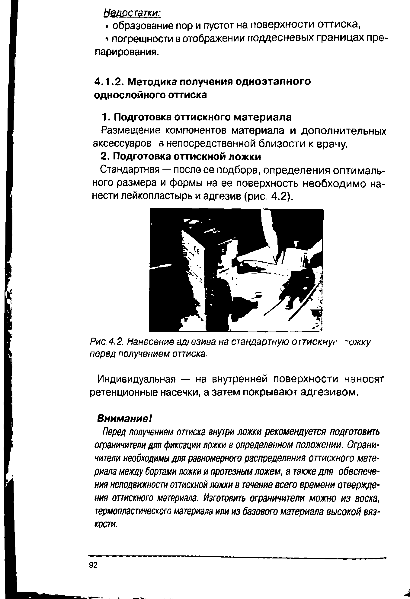 Рис. 4.2. Нанесение адгезива на стандартную оттискнуг -ожку перед получением оттиска.