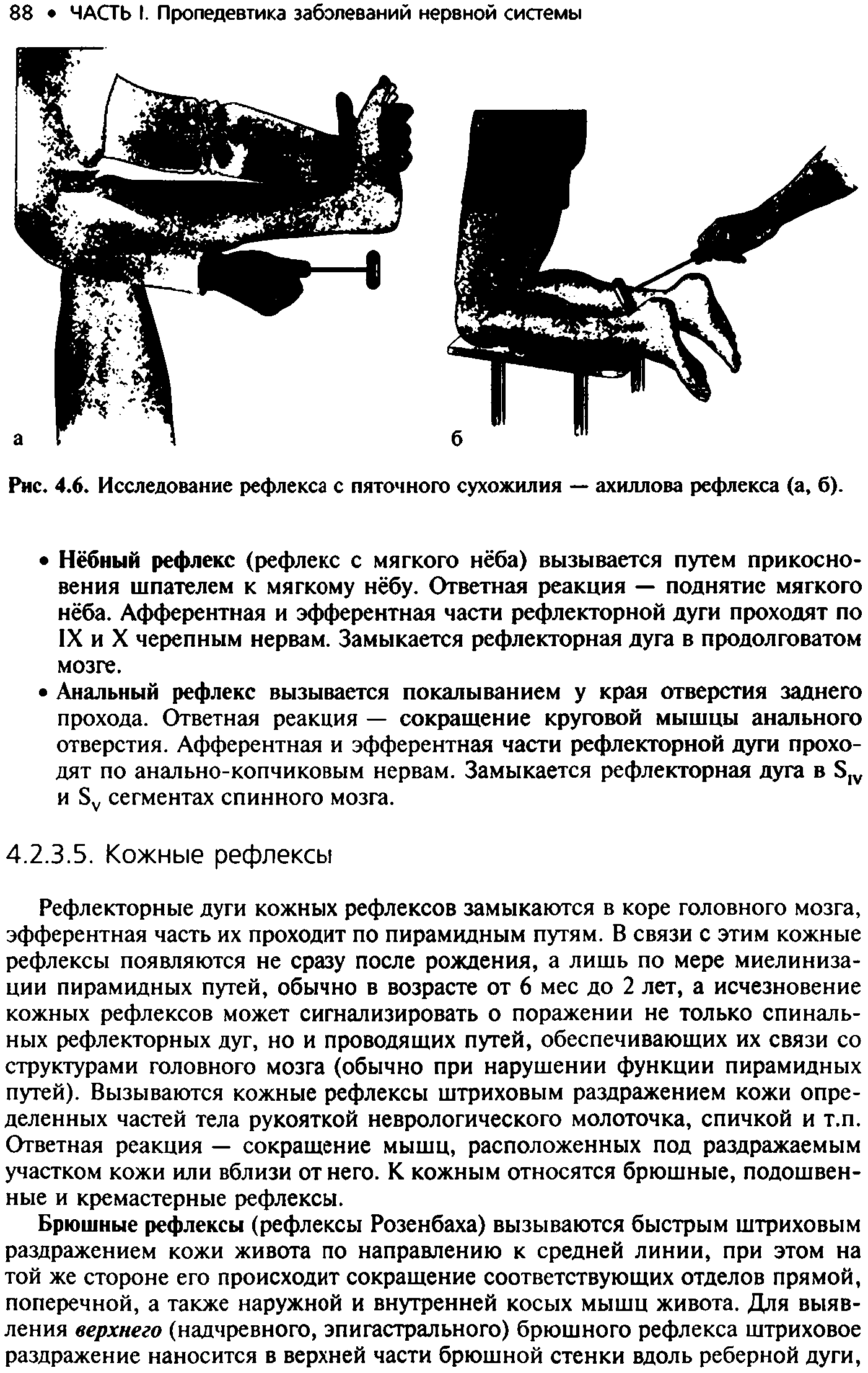 Рис. 4.6. Исследование рефлекса с пяточного сухожилия — ахиллова рефлекса (а, б).