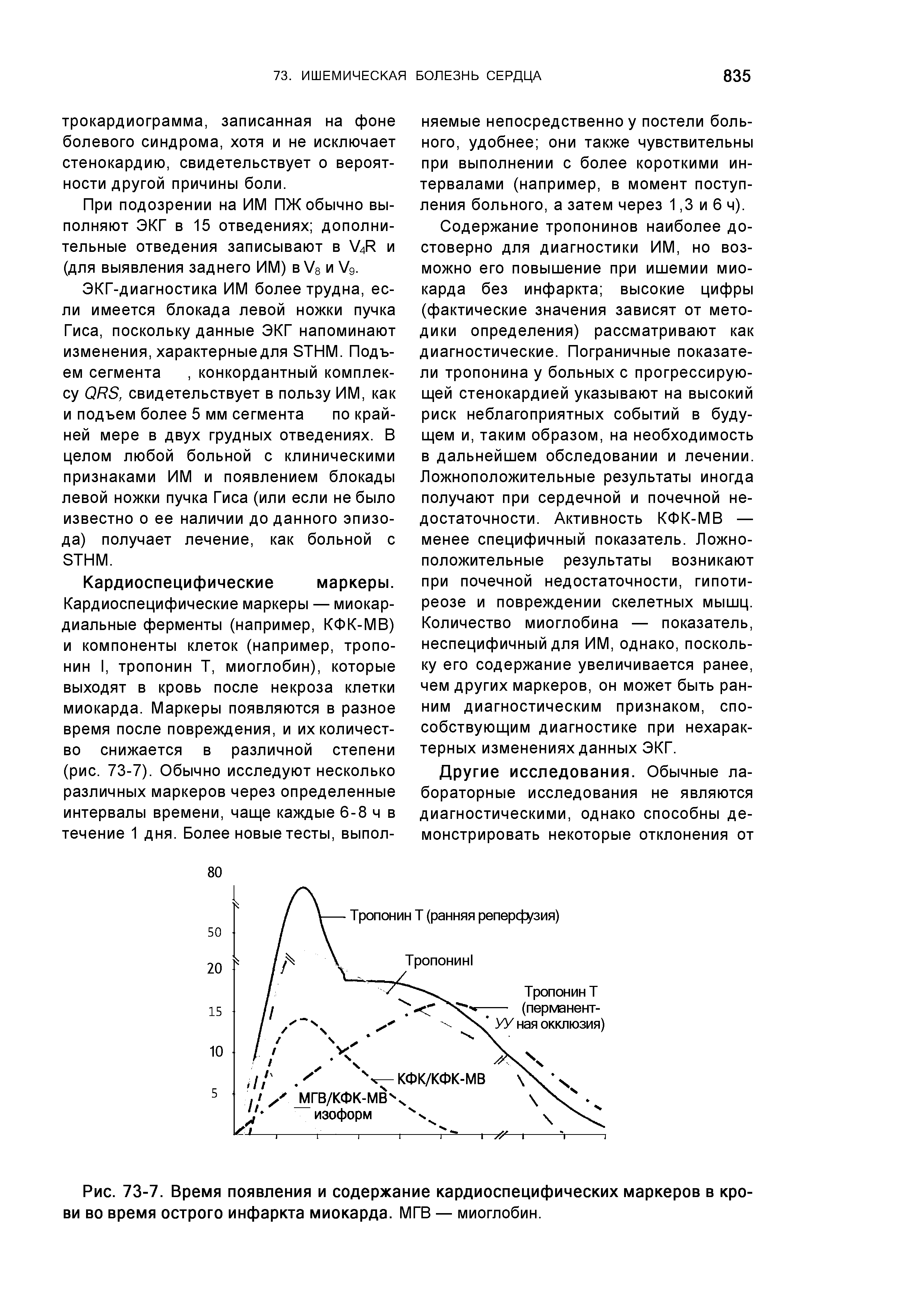 Рис. 73-7. Время появления и содержание кардиоспецифических маркеров в крови во время острого инфаркта миокарда. МГВ — миоглобин.