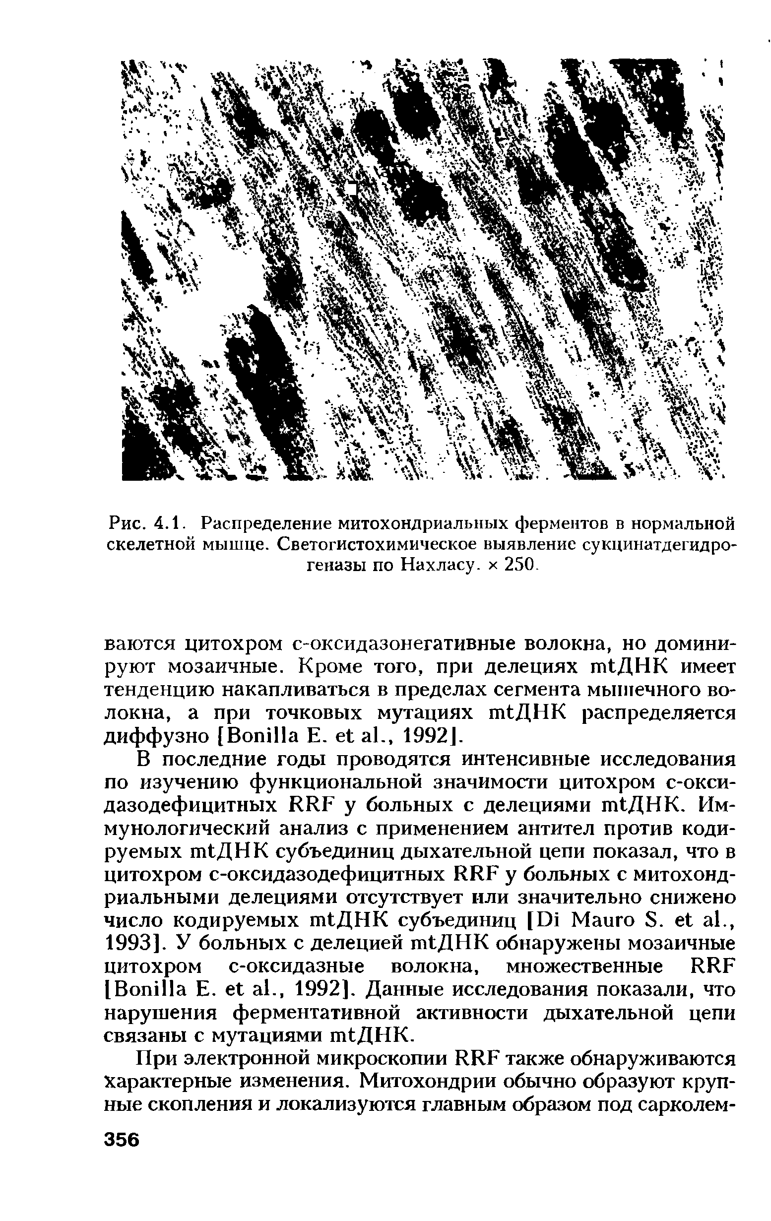 Рис. 4.1. Распределение митохондриальных ферментов в нормальной скелетной мышце. Светогистохимическое выявление сукцинатдегидрогеназы по Нахласу. х 250.