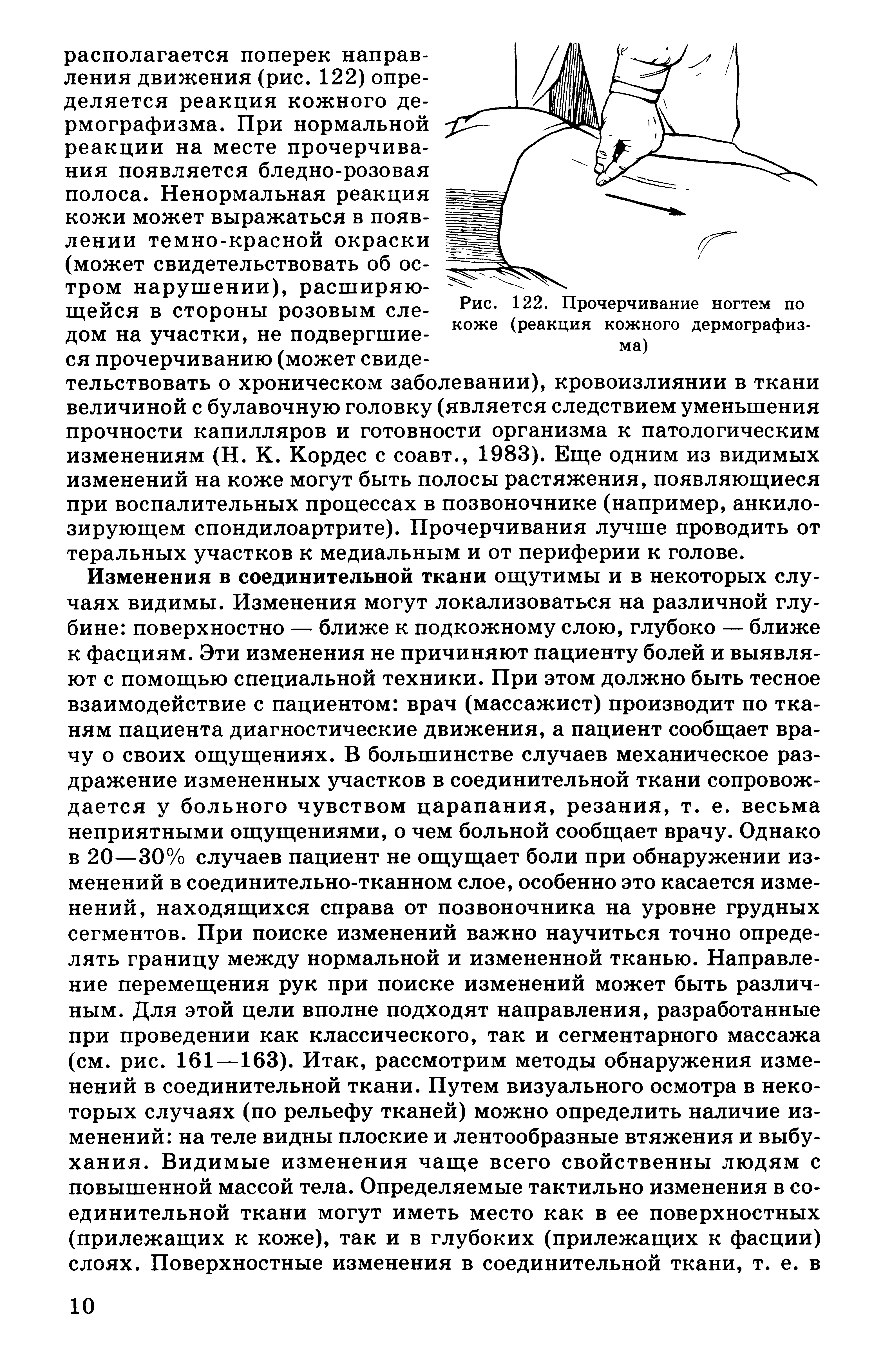 Рис. 122. Прочерчивание ногтем по коже (реакция кожного дермографизма)...