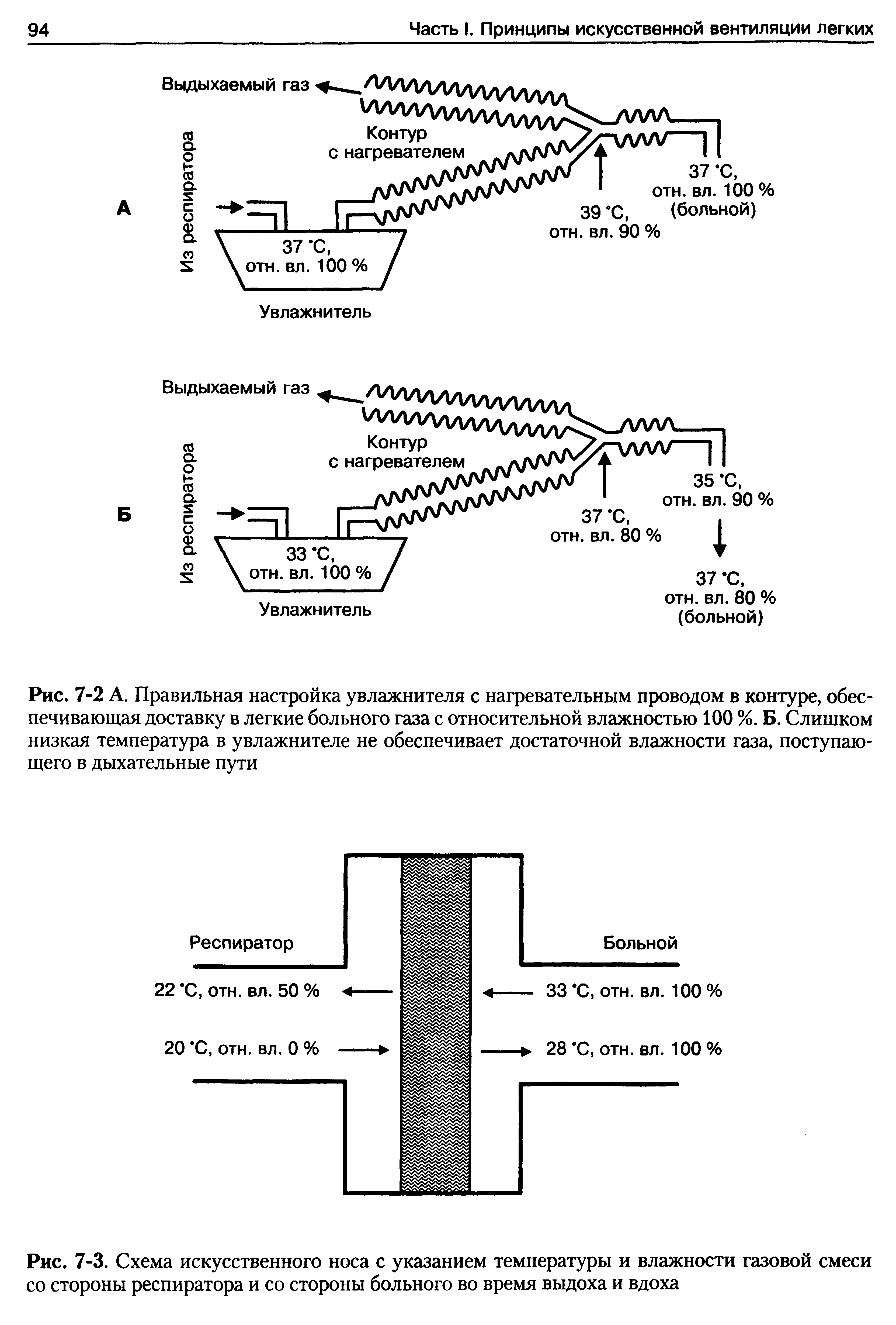 Рис. 7-3. Схема искусственного носа с указанием температуры и влажности газовой смеси со стороны респиратора и со стороны больного во время выдоха и вдоха...