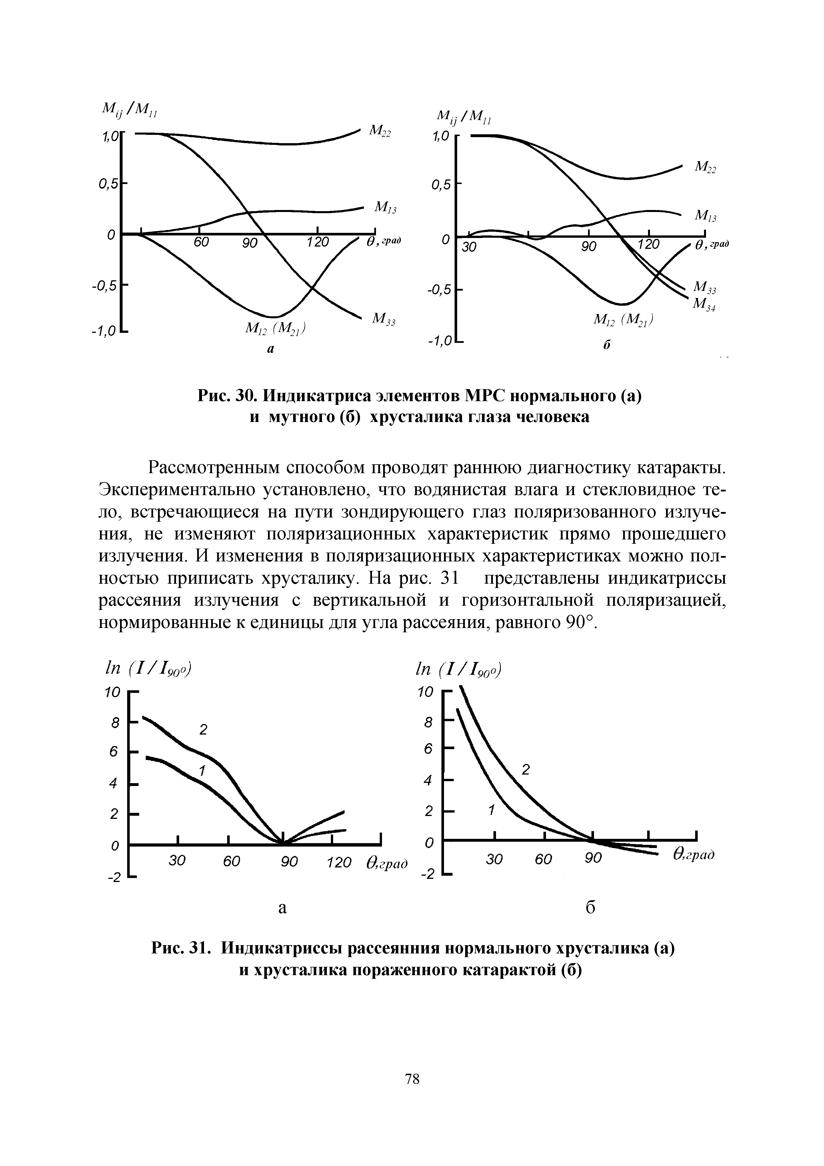 Рис. 31. Индикатриссы рассеянния нормального хрусталика (а) и хрусталика пораженного катарактой (б)...