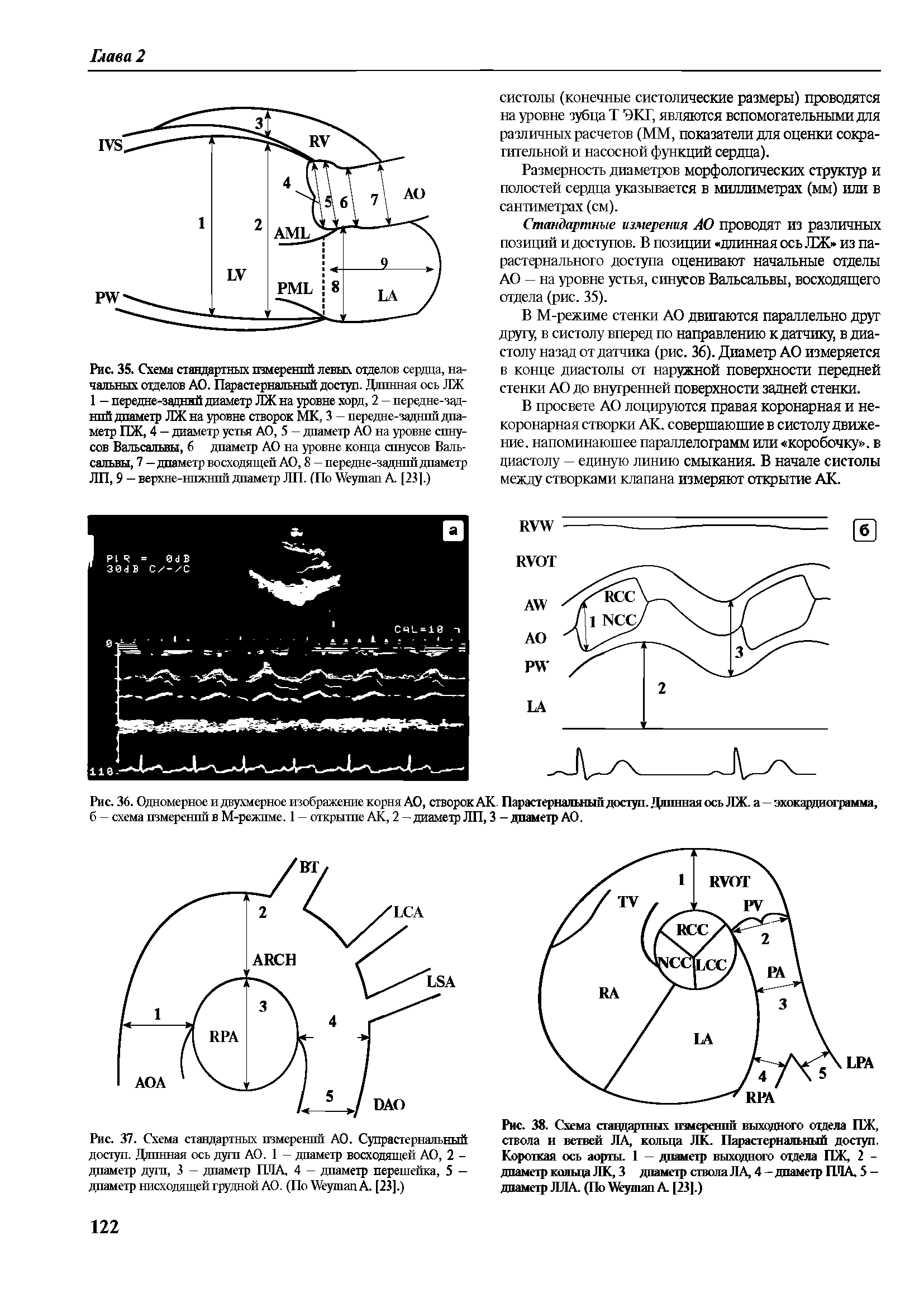 Рис. 36. Одномерное и двухмерное изображение корня АО, створок АК. Парастернальный доступ. Длинная ось ЛЖ. а—эхокардиограмма, б — схема измерений в М-режпме. 1 — открытие АК, 2 — диаметр ЛП, 3 - диаметр АО.