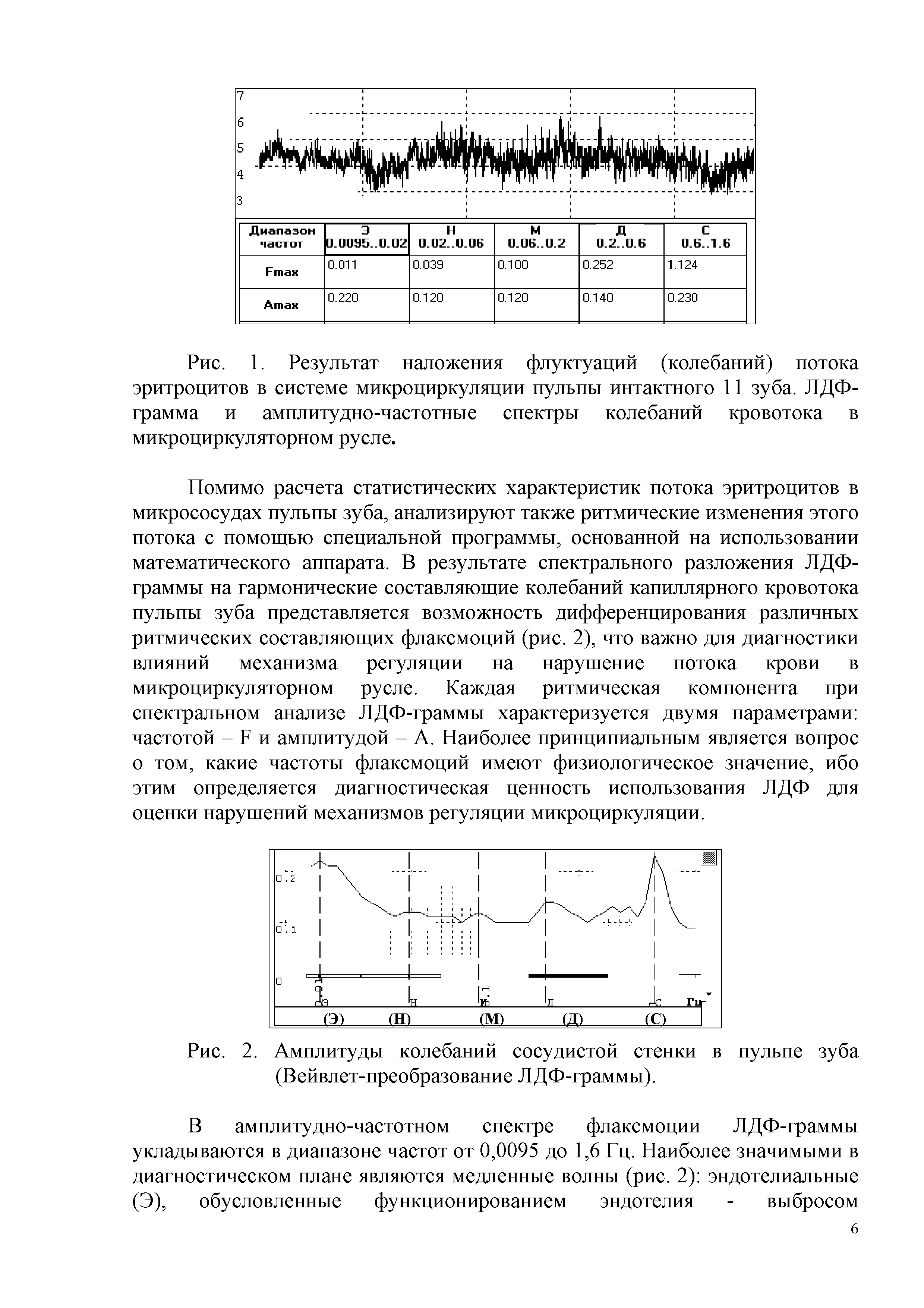 Рис. 1. Результат наложения флуктуаций (колебаний) потока эритроцитов в системе микроциркуляции пульпы интактного 11 зуба. ЛДФ-грамма и амплитудно-частотные спектры колебаний кровотока в микроциркуляторном русле.