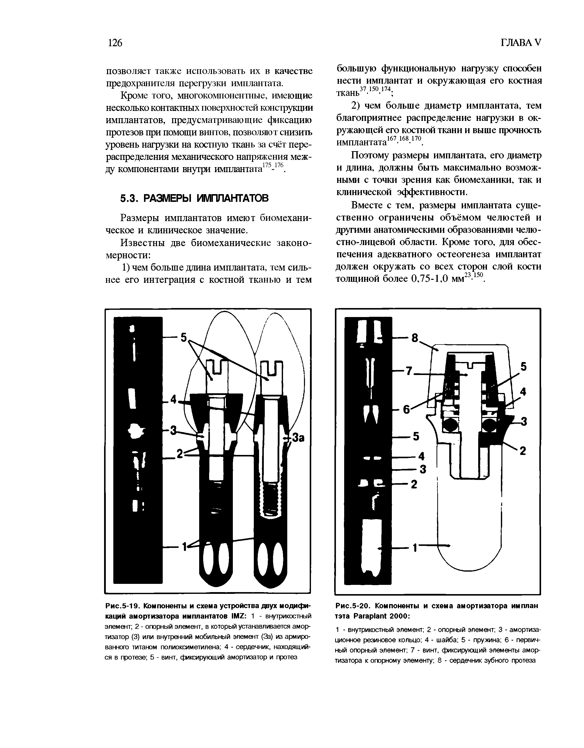 Рис.5-19. Компоненты и схема устройства двух модификаций амортизатора имплантатов 1М2 1 - внутрикостный элемент 2 - опорный элемент, в который устанавливается амортизатор (3) или внутренний мобильный элемент (За) из армиро-ваннопэ титаном полиоксиметилена 4 - сердечник, находящийся в протезе 5 - винт, фиксирующий амортизатор и протез...