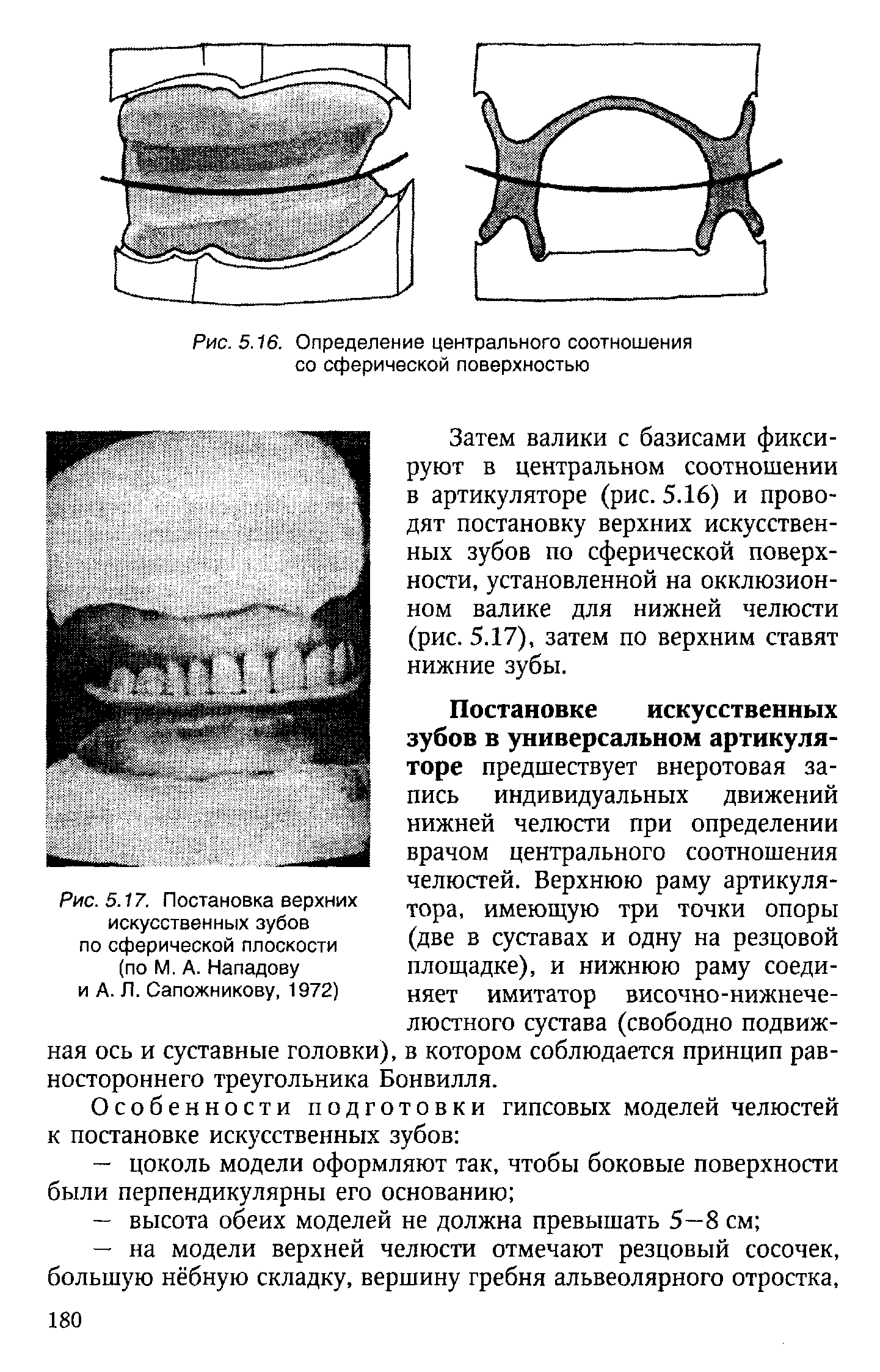 Рис. 5.17. Постановка верхних искусственных зубов по сферической плоскости (по М. А. Нападову и А. Л. Сапожникову, 1972)...