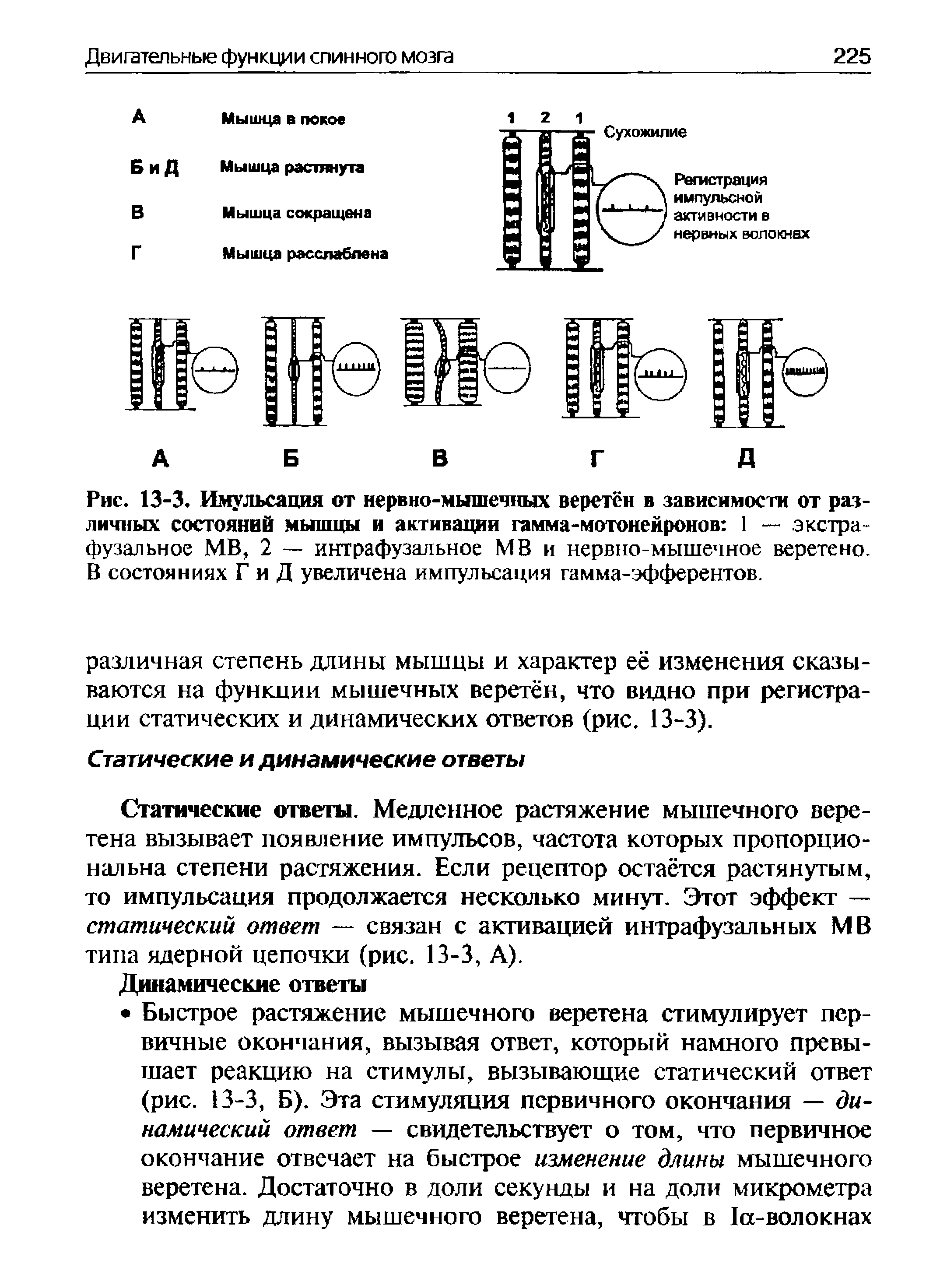 Рис. 13-3. Имульсация от нервно-мышечных веретён в зависимости от различных состояний мышцы и активации гамма-мотонейронов 1 — экстра-фузальное МВ, 2 — интрафузальное МВ и нервно-мышечное веретено. В состояниях Г и Д увеличена импульсация гамма-эфферентов.