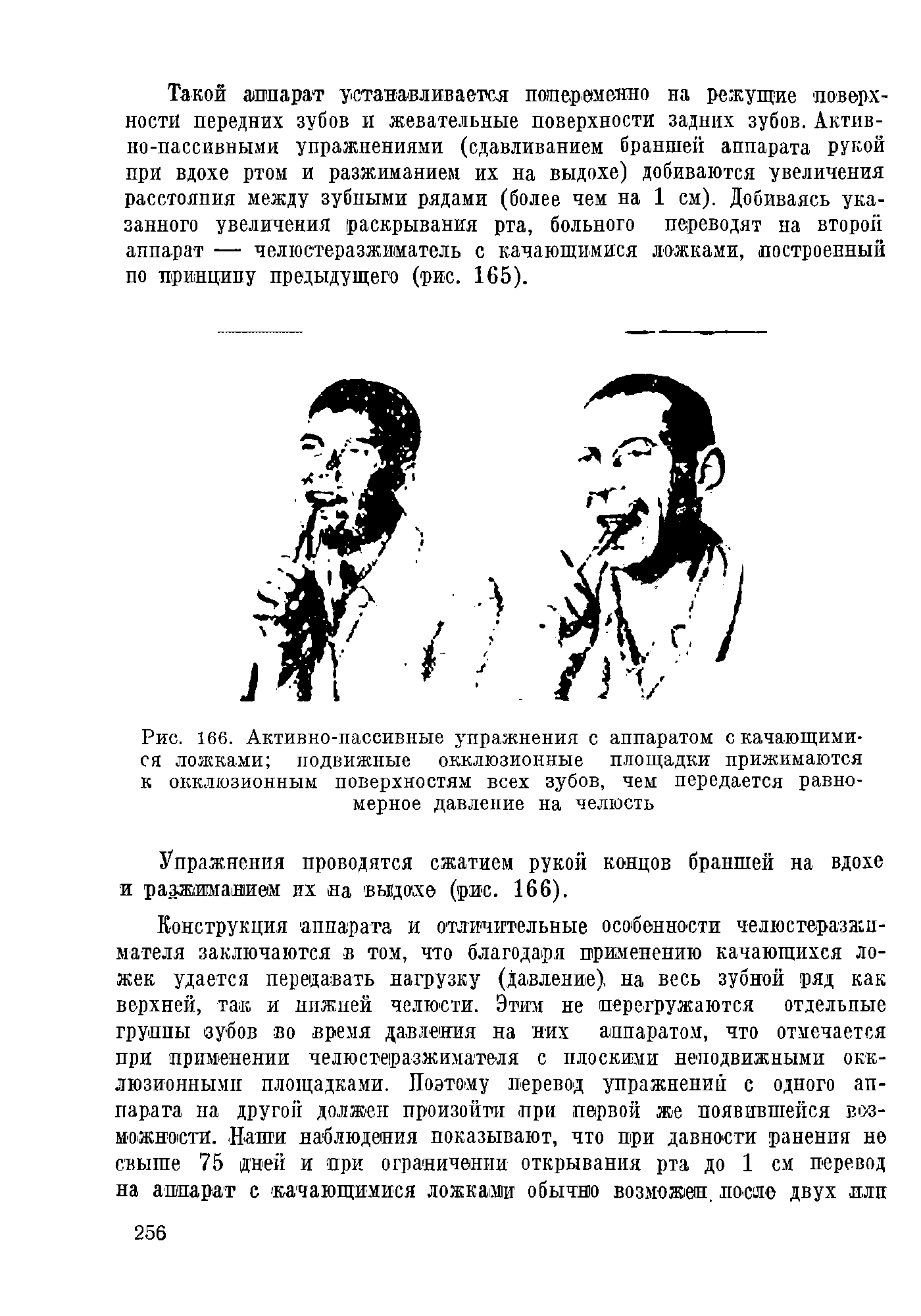 Рис. 166. Активно-пассивные упражнения с аппаратом с качающимися ложками подвижные окклюзионные площадки прижимаются к окклюзионным поверхностям всех зубов, чем передается равномерное давление на челюсть...