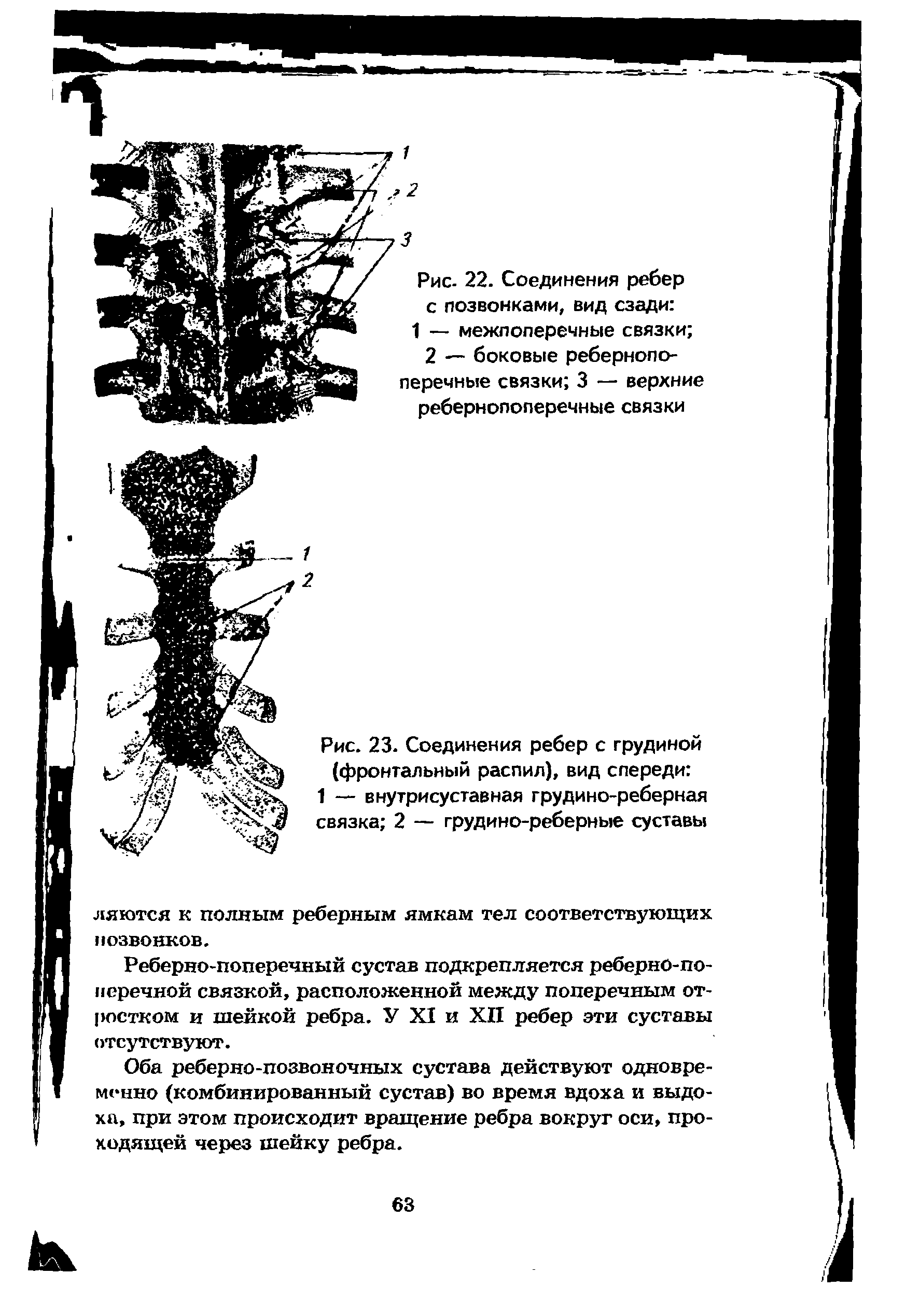 Рис. 23. Соединения ребер с грудиной (фронтальный распил), вид спереди 1 — внутрисуставная грудино-реберная связка 2 — грудино-реберные суставы...