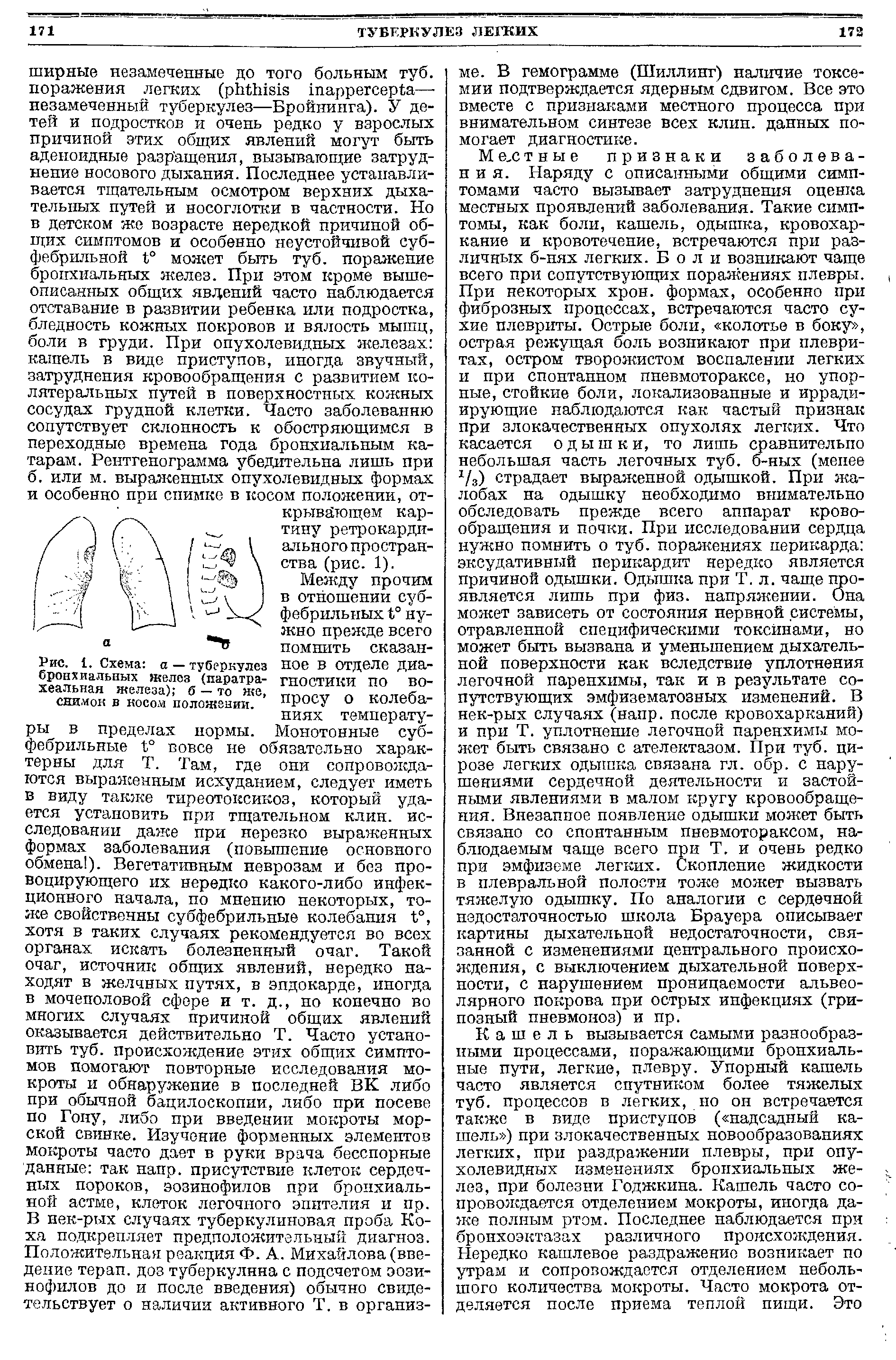 Рис. 1. Схема а — туберкулез бронхиальных желез (паратра-хеальная железа) б — то же, снимок в косом положении.