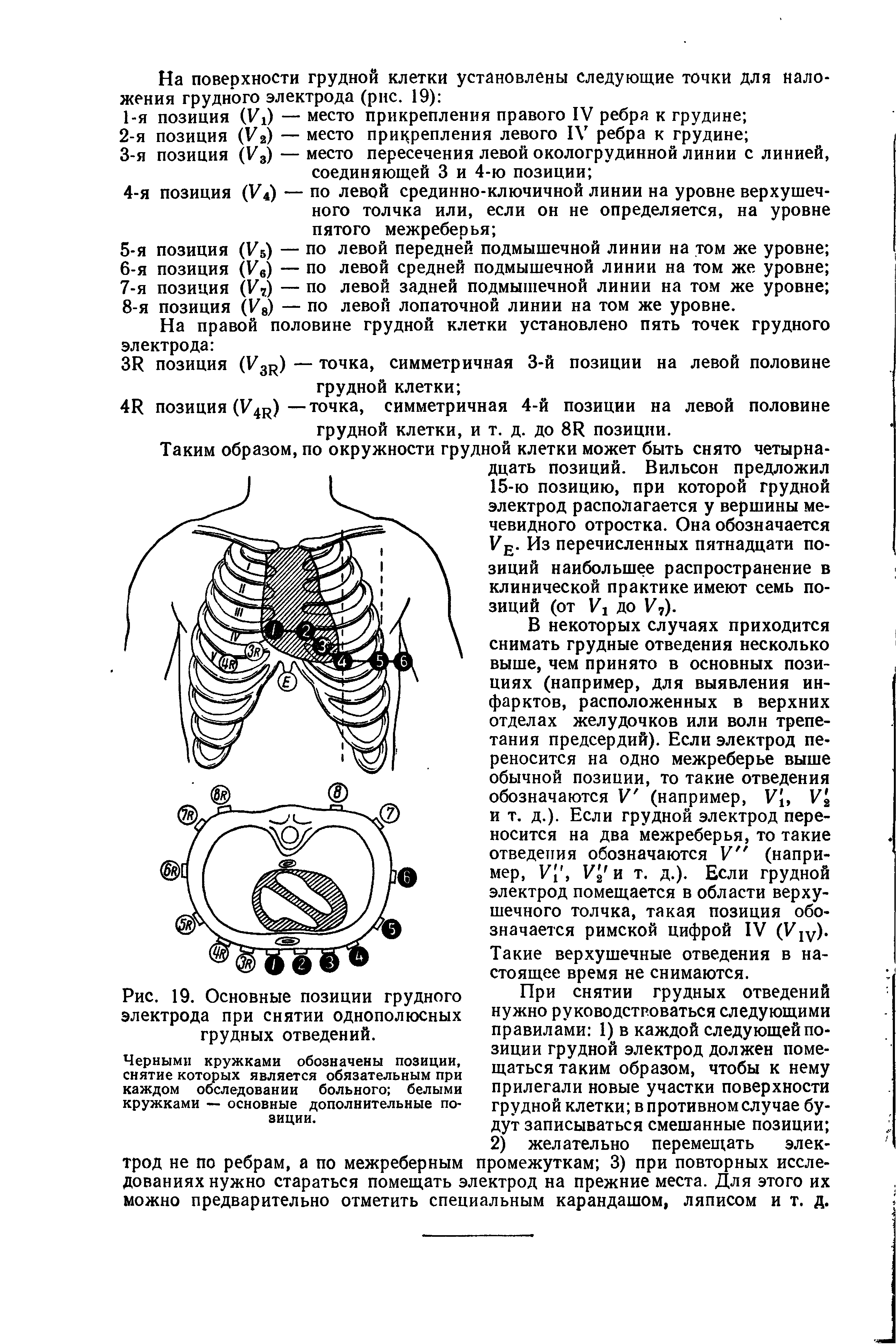 Рис. 19. Основные позиции грудного электрода при снятии однополюсных грудных отведений.