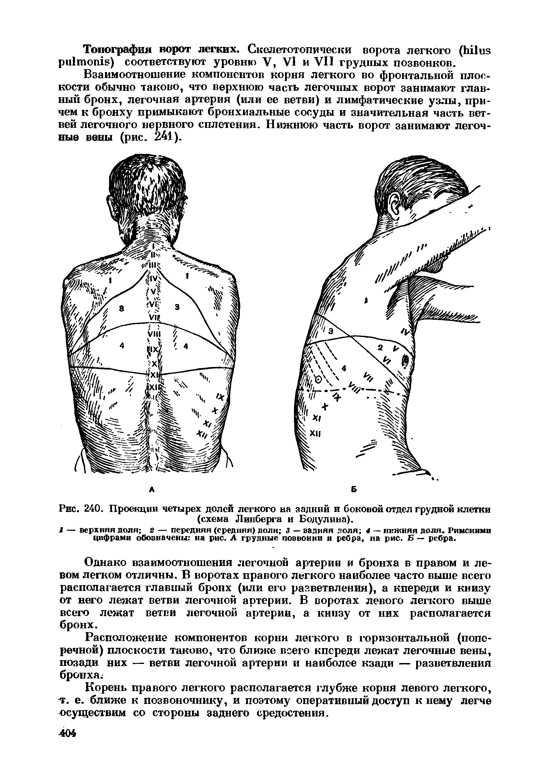Рис. 240. Проекции четырех долей легкого на задний и боковой отдел грудной клетки (схема Линберга и Бодулина).