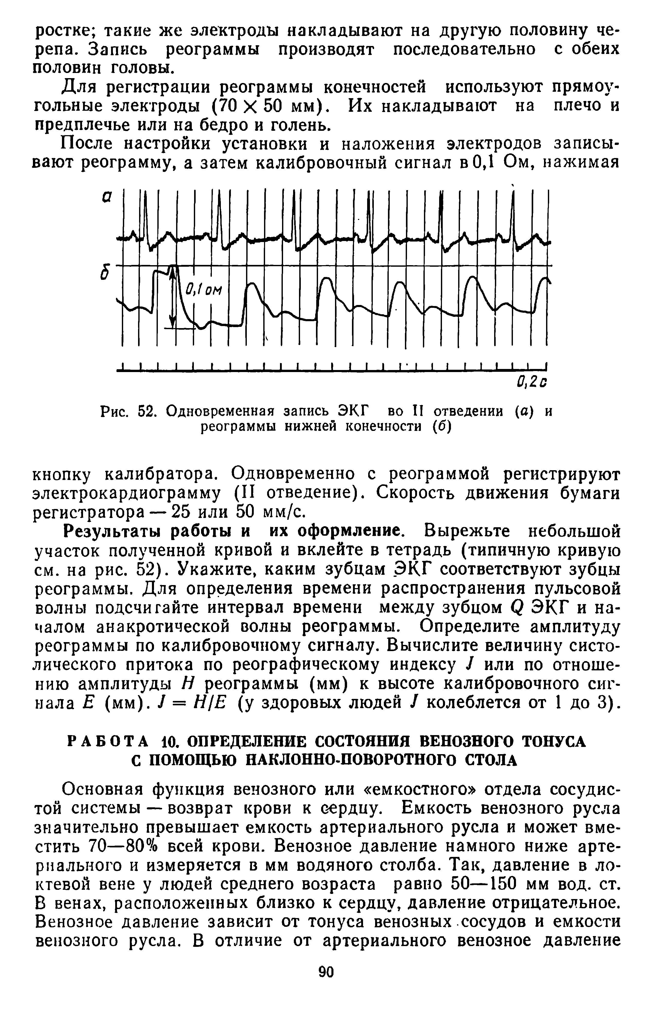 Рис. 52. Одновременная запись ЭКГ во II отведении (о) и реограммы нижней конечности (б)...