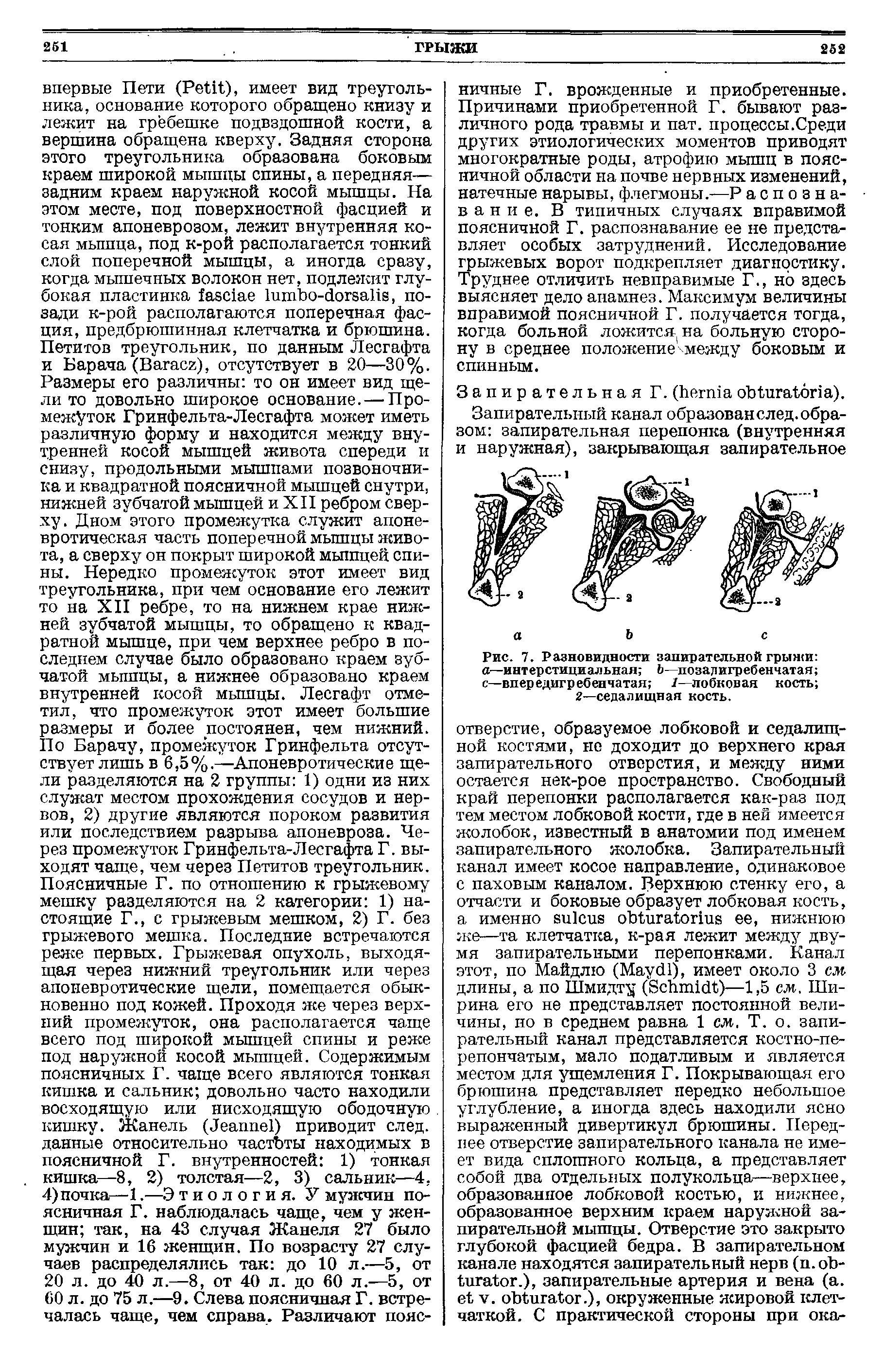 Рис. 7. Разновидности запирательной грыжи а—интерстициальная Ъ—позадигребенчатая с—впередигребенчатая 1—лобковая кость 2—седалищная кость.