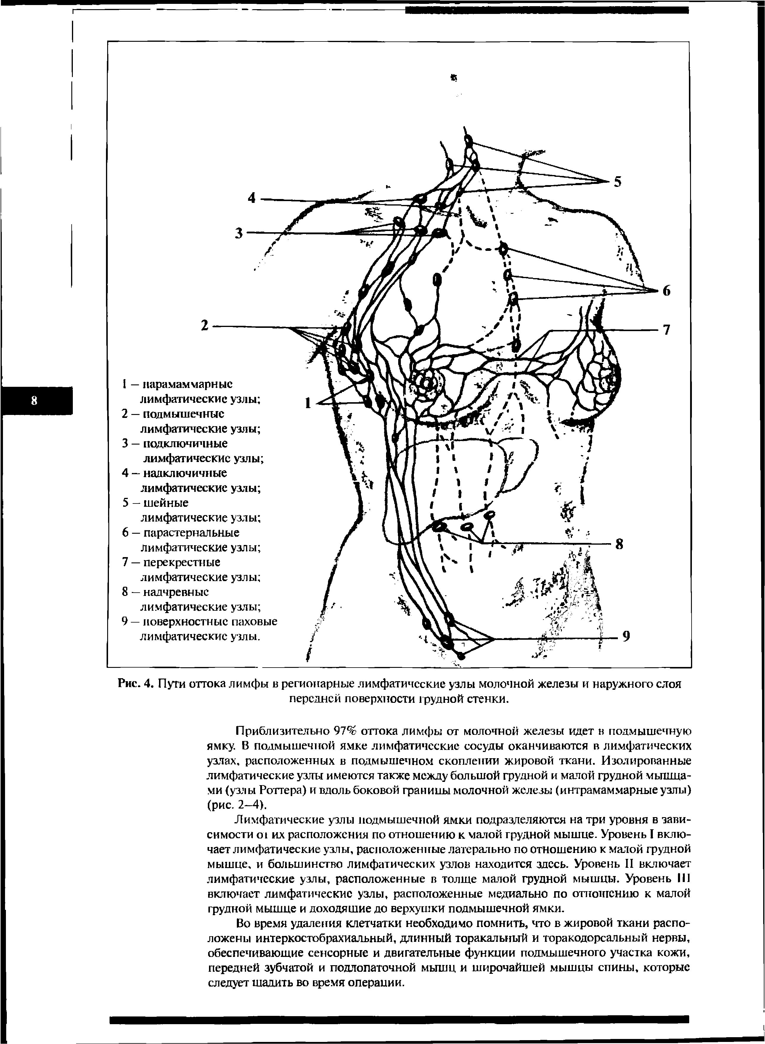 Рис. 4. Пути оттока лимфы в регионарные лимфатические узлы молочной железы и наружного слоя передней поверхности грудной стенки.