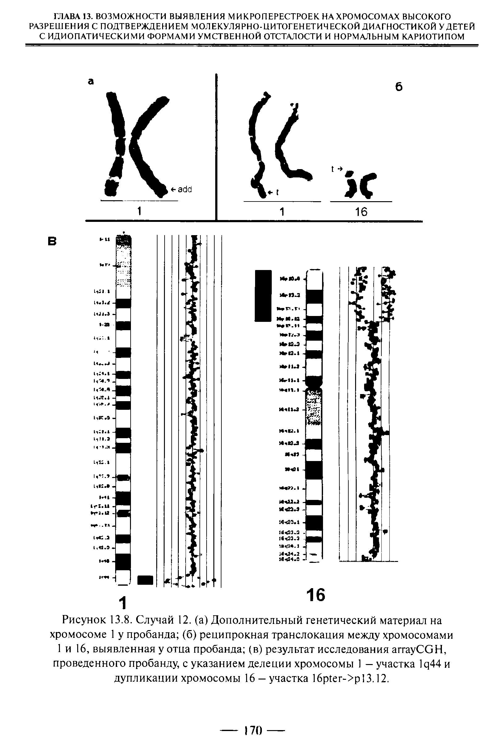 Рисунок 13.8. Случай 12. (а) Дополнительный генетический материал на хромосоме 1 у пробанда (б) реципрокная транслокация между хромосомами 1 и 16, выявленная у отца пробанда (в) результат исследования аггауСОН, проведенного пробанду, с указанием делеции хромосомы 1 — участка 1 ц44 и дупликации хромосомы 16 - участка 16р1ег->р13.12.