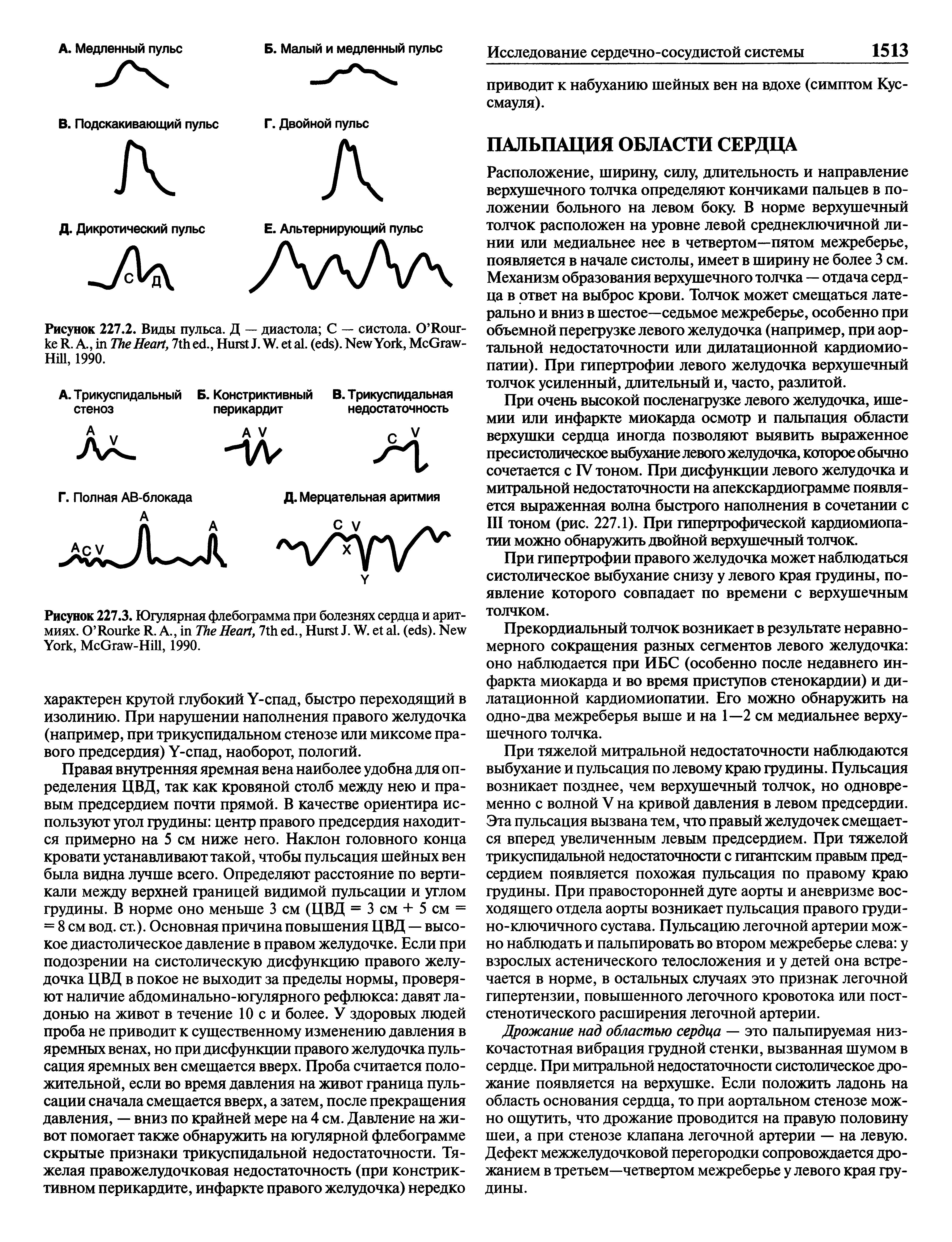 Рисунок 227.3. Югулярная флебограмма при болезнях сердца и аритмиях. O R R. A., T H , 7 ., H J. W. . ( ). N Y , M G -H , 1990.