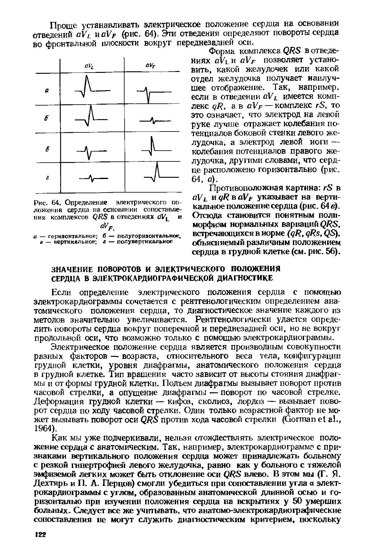 Рис. 64. Определение электрического положения сердца на основании сопоставления комплексов фЯЯ в отведениях и...