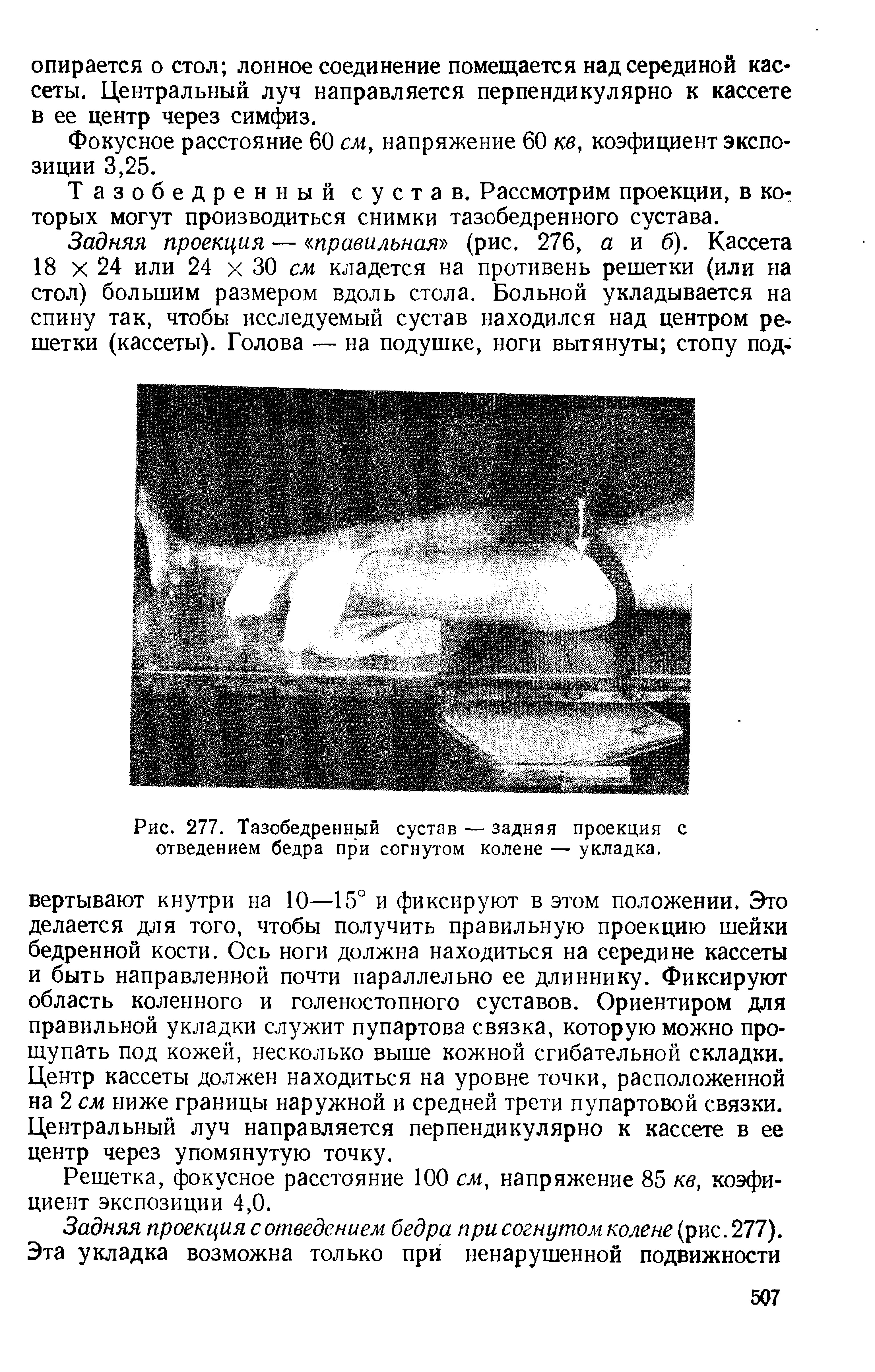 Рис. 277. Тазобедренный сустав — задняя проекция с отведением бедра при согнутом колене — укладка.