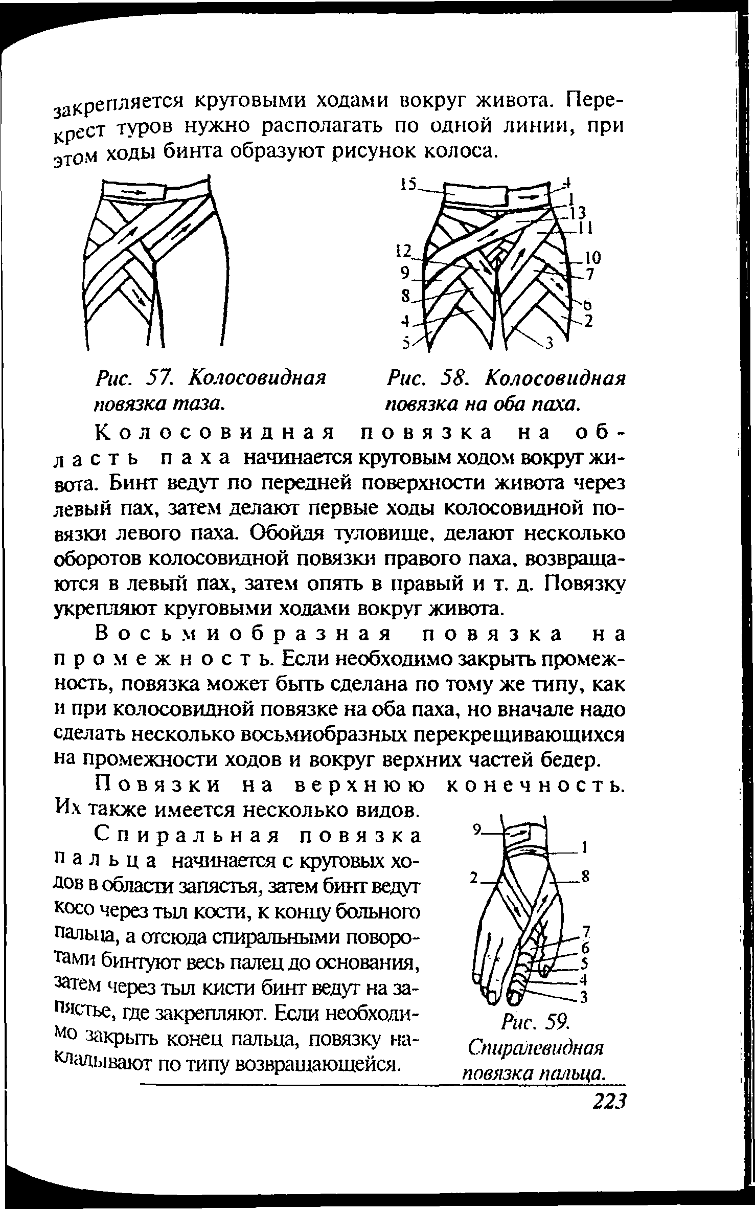 Рис. 57. Колосовидная Рис. 58. Колосовидная повязка таза. повязка на оба паха.