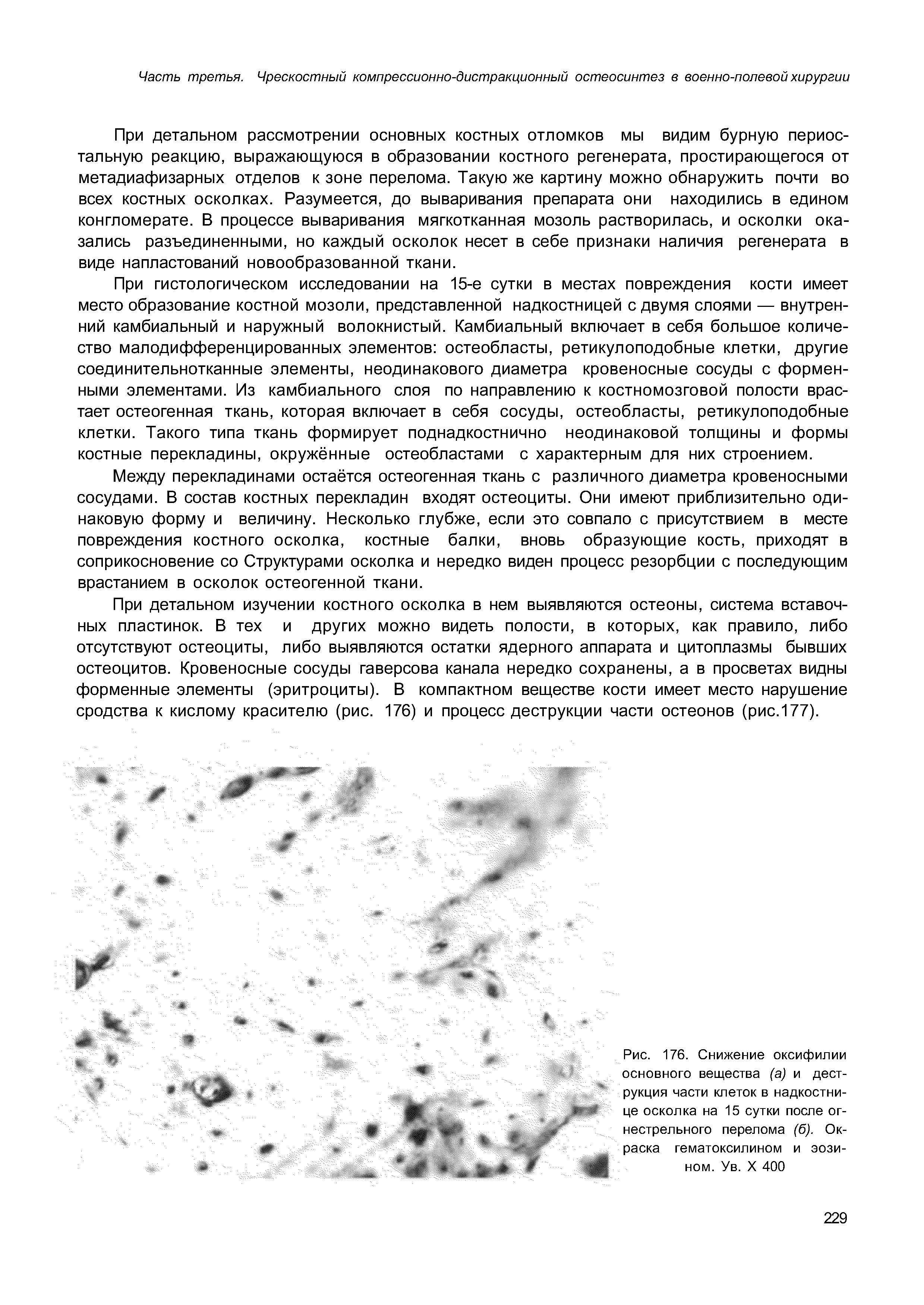 Рис. 176. Снижение оксифилии основного вещества (а) и деструкция части клеток в надкостнице осколка на 15 сутки после огнестрельного перелома (б). Окраска гематоксилином и эозином. Ув. X 400...