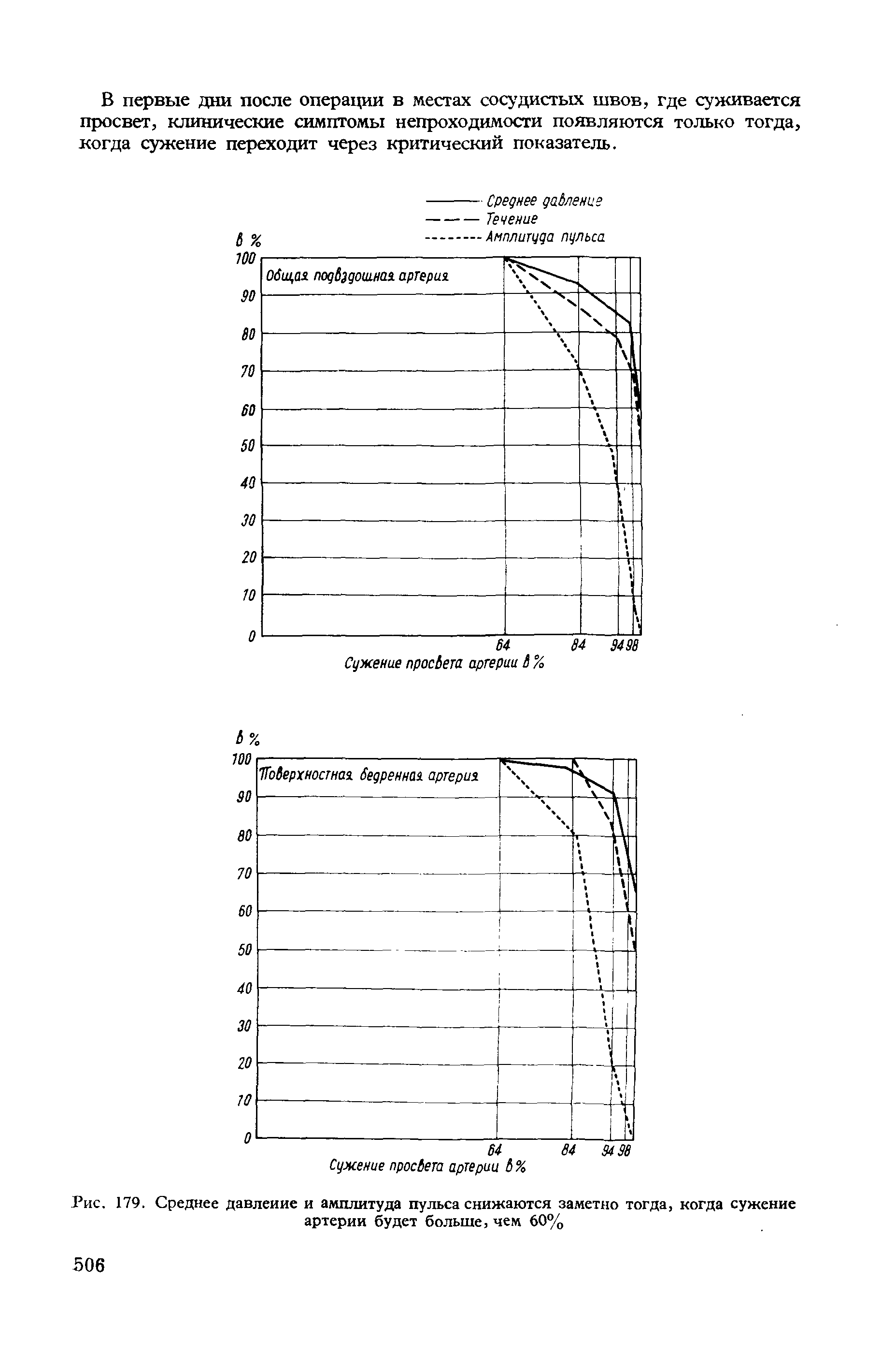Рис. 179. Среднее давление и амплитуда пульса снижаются заметно тогда, когда сужение артерии будет больше, чем 60%...