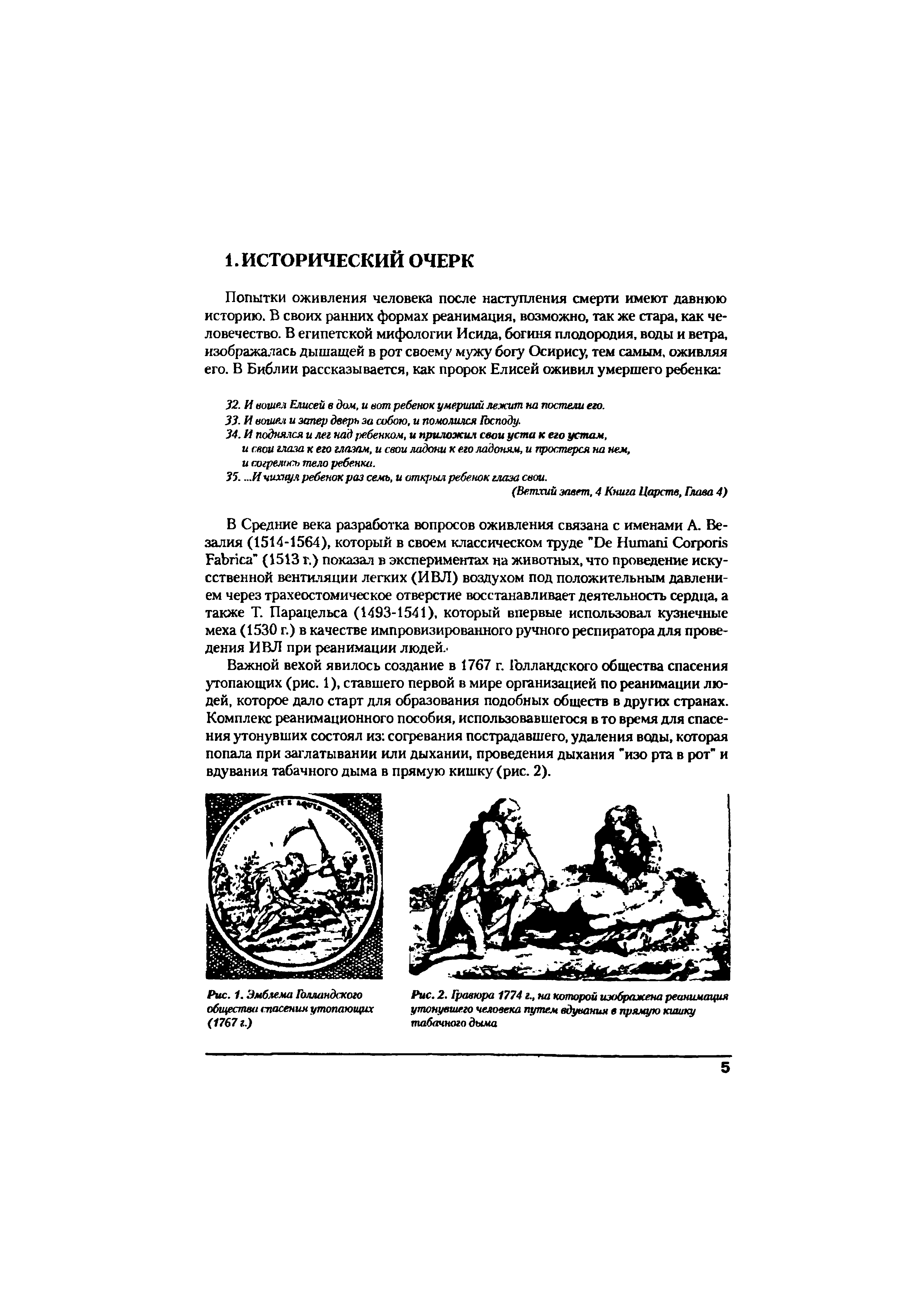 Рис. 2. Гравюра 1774 г., на которой изображена реанимация утонувшею человека путем вдувания в прямую кишку табачного дыма...