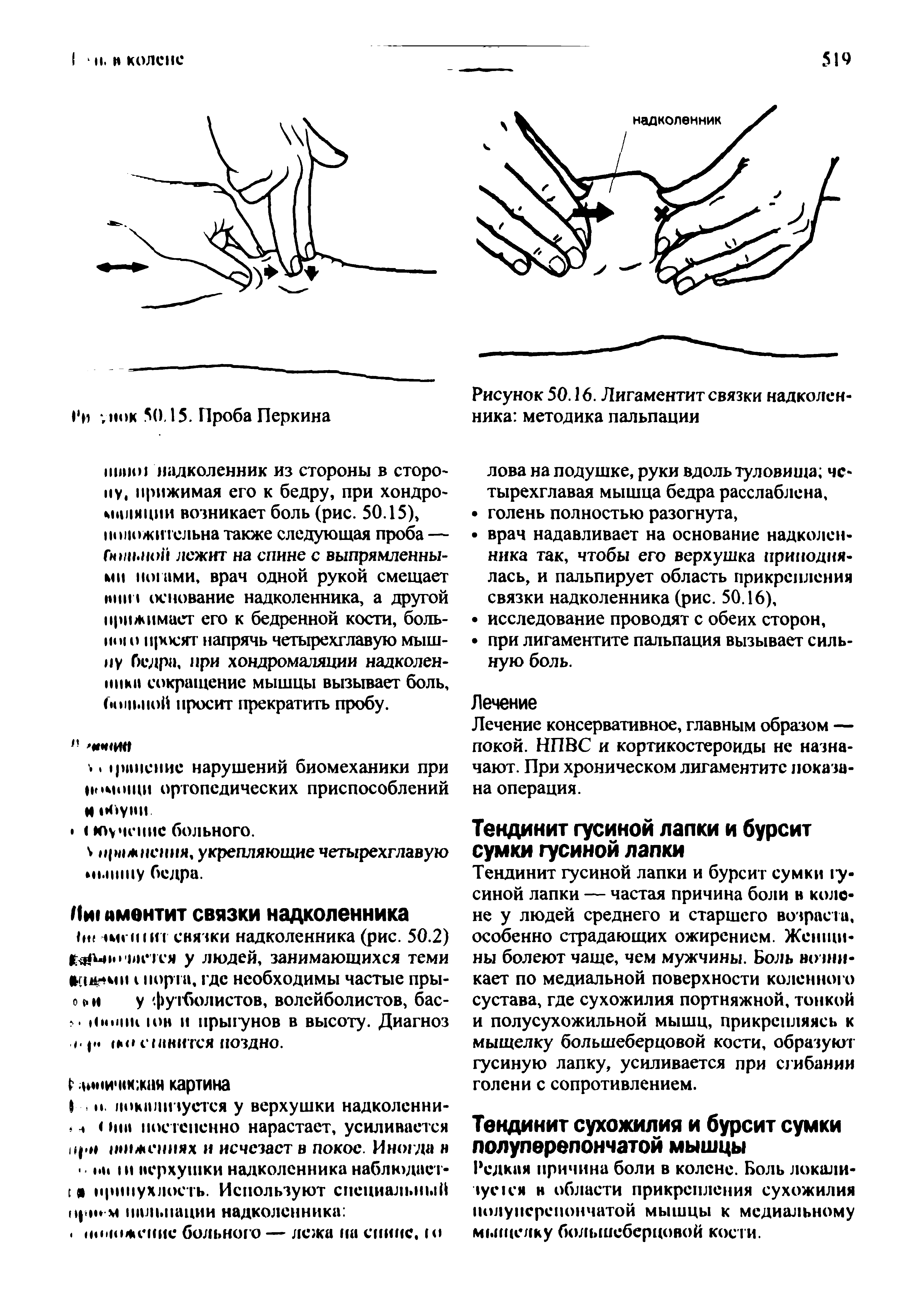 Рисунок 50.16. Лигаментит связки надколенника методика пальпации...