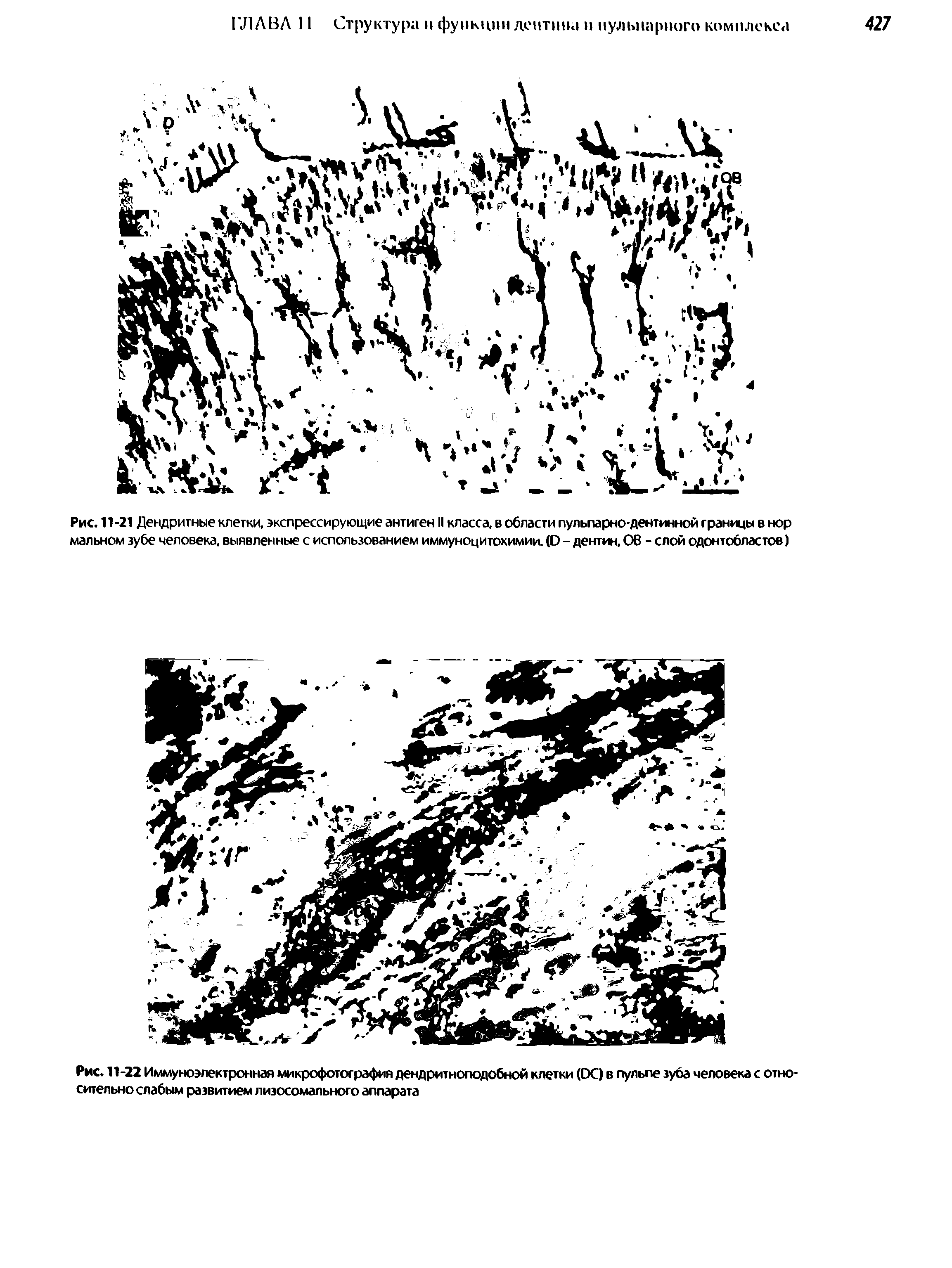 Рис. 11-21 Дендритные клетки, экспрессирующие антиген II класса, в области пульпарно-дентинной границы в нор мальном зубе человека, выявленные с использованием иммуноцитохимии. (О - дентин, ОВ - слой одонтобластов)...