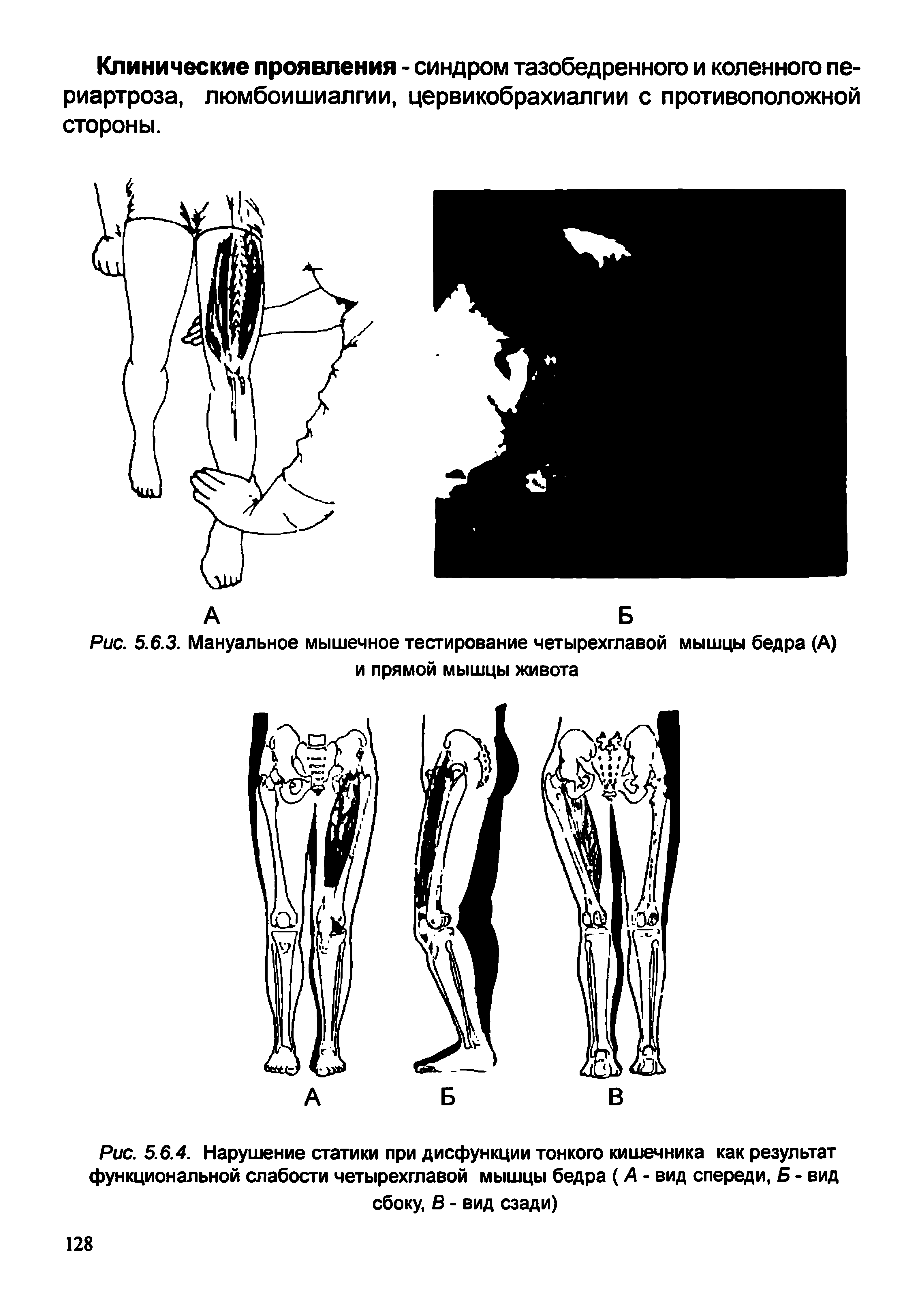 Рис. 5.6.3. Мануальное мышечное тестирование четырехглавой мышцы бедра (А) и прямой мышцы живота...