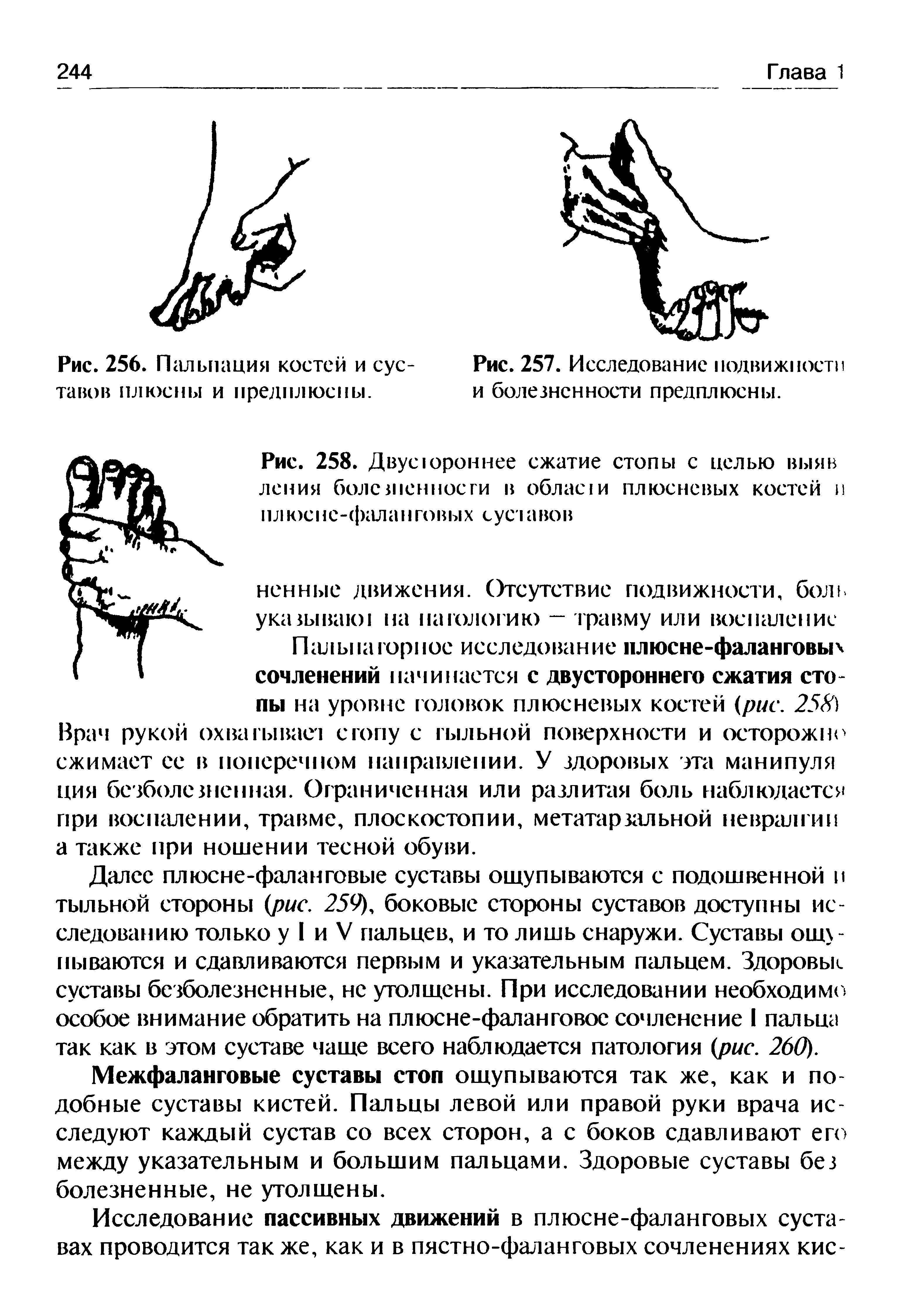 Рис. 258. Двусюроннее сжатие стопы с целью вы я в лепим болезненности в области плюсневых костей п плюсне-фаланговых суставов...