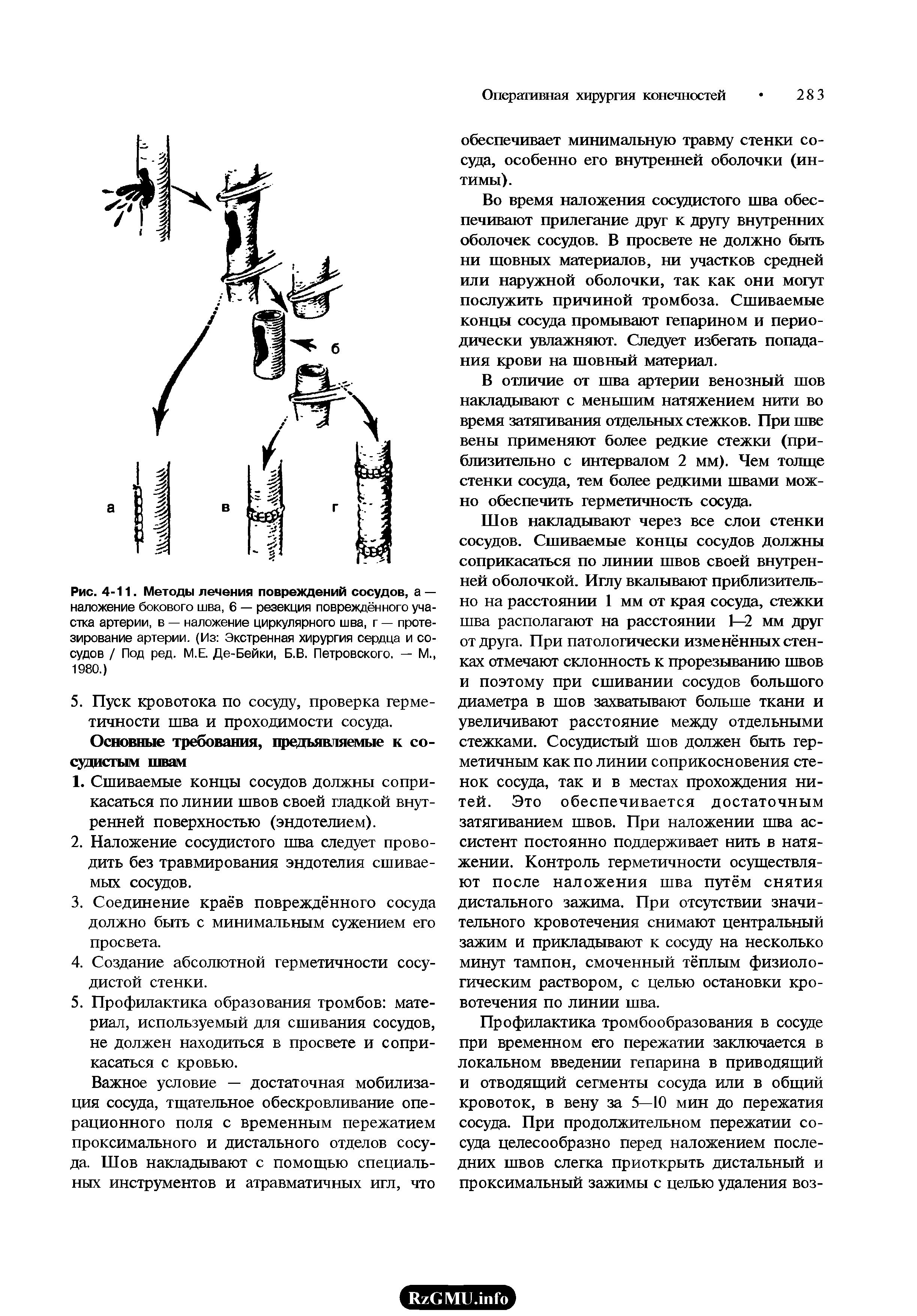 Рис. 4-11. Методы лечения повреждений сосудов, а — наложение бокового шва, 6 — резекция повреждённого участка артерии, в — наложение циркулярного шва, г — протезирование артерии. (Из Экстренная хирургия сердца и сосудов / Под ред. М.Е. Де-Бейки, Б.В. Петровского. — М., 1980.)...