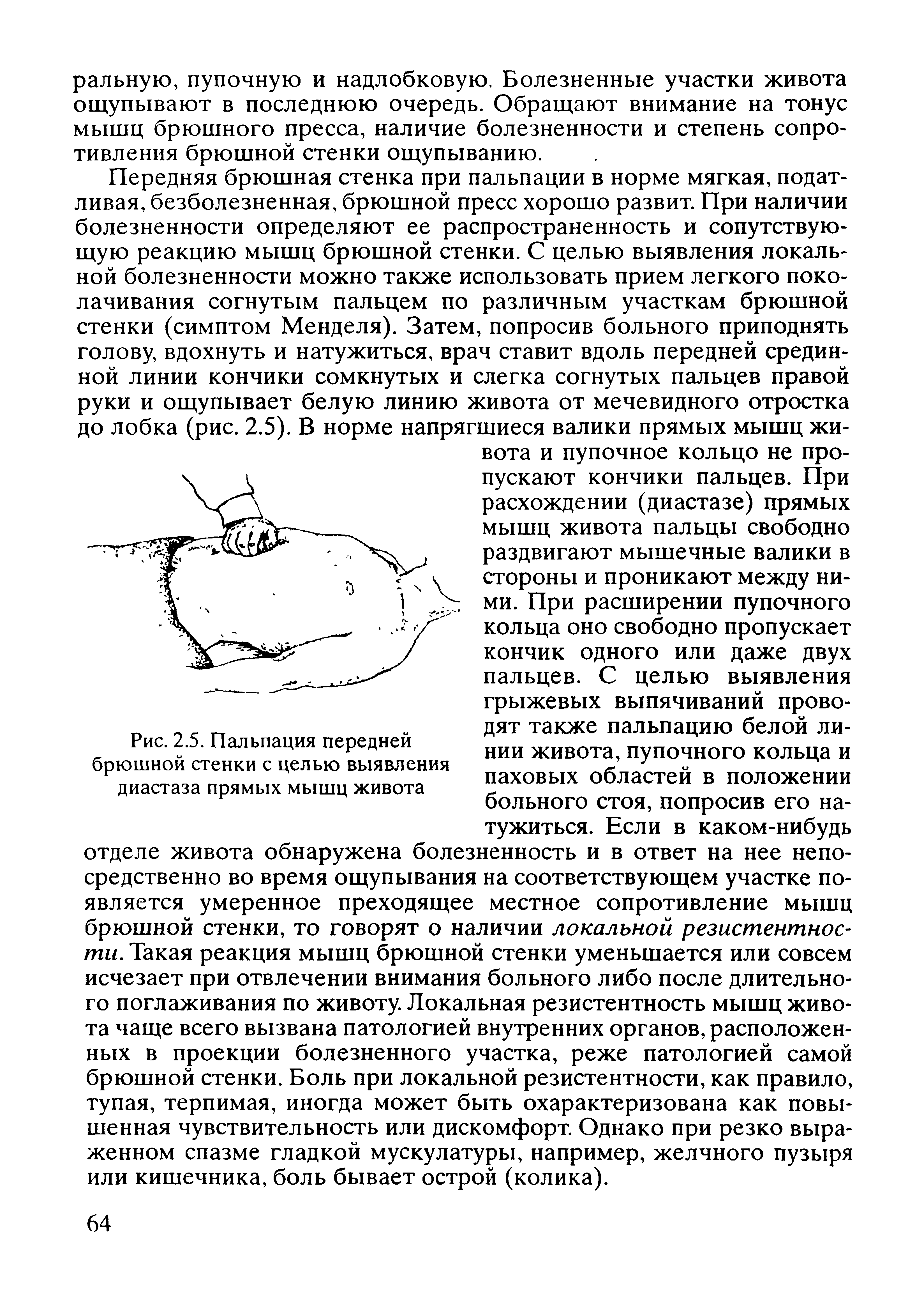 Рис. 2.5. Пальпация передней брюшной стенки с целью выявления диастаза прямых мышц живота...