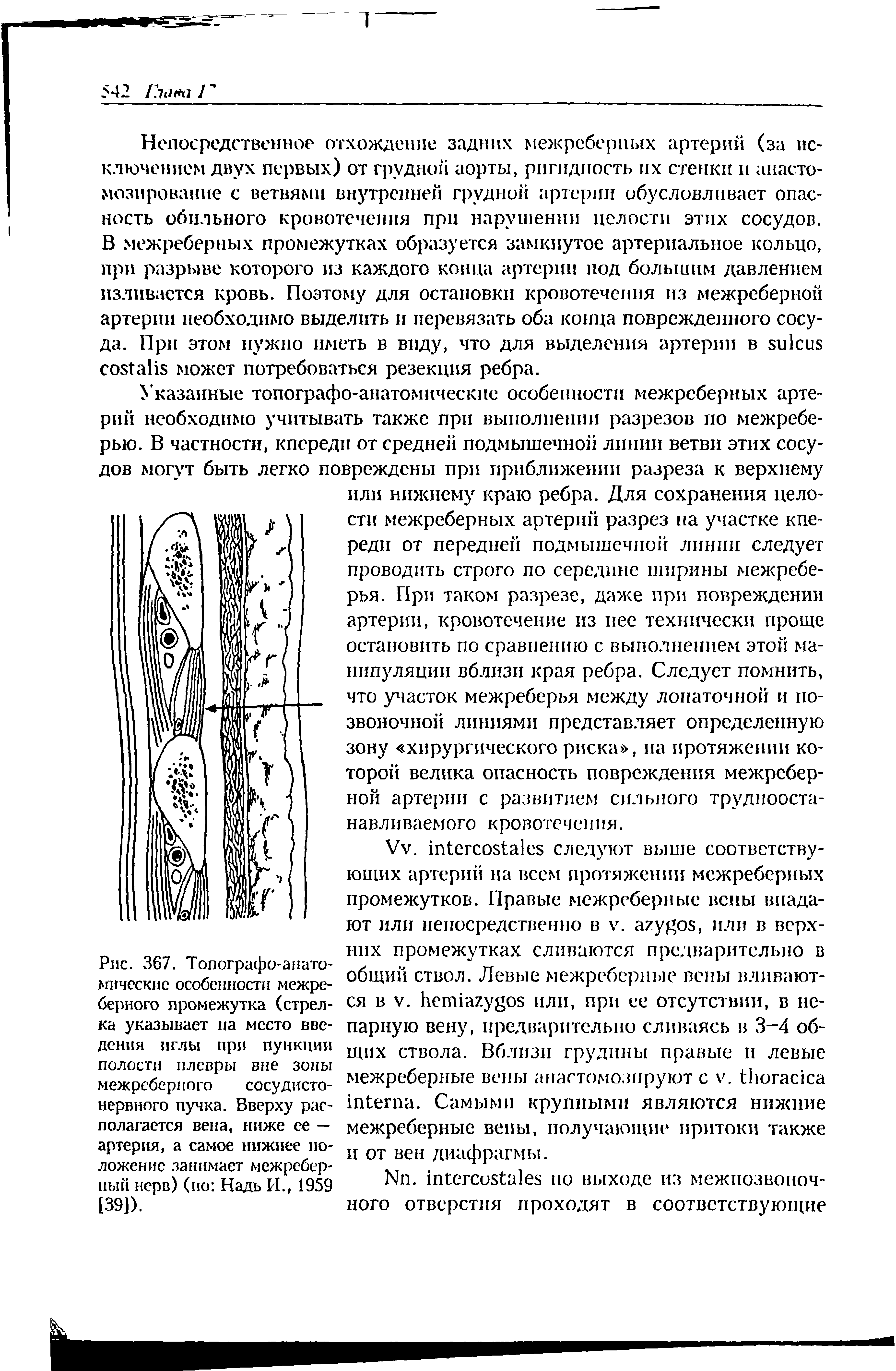 Рис. 367. Топографо-анатомические особенности межреберного промежутка (стрелка указывает па место введения иглы при пункции полости плевры вне зоны межреберного сосудистонервного пучка. Вверху располагается вена, ниже ее — артерия, а самое нижнее положение занимает межребер-ный нерв) (по Надь И., 1959 [39]).