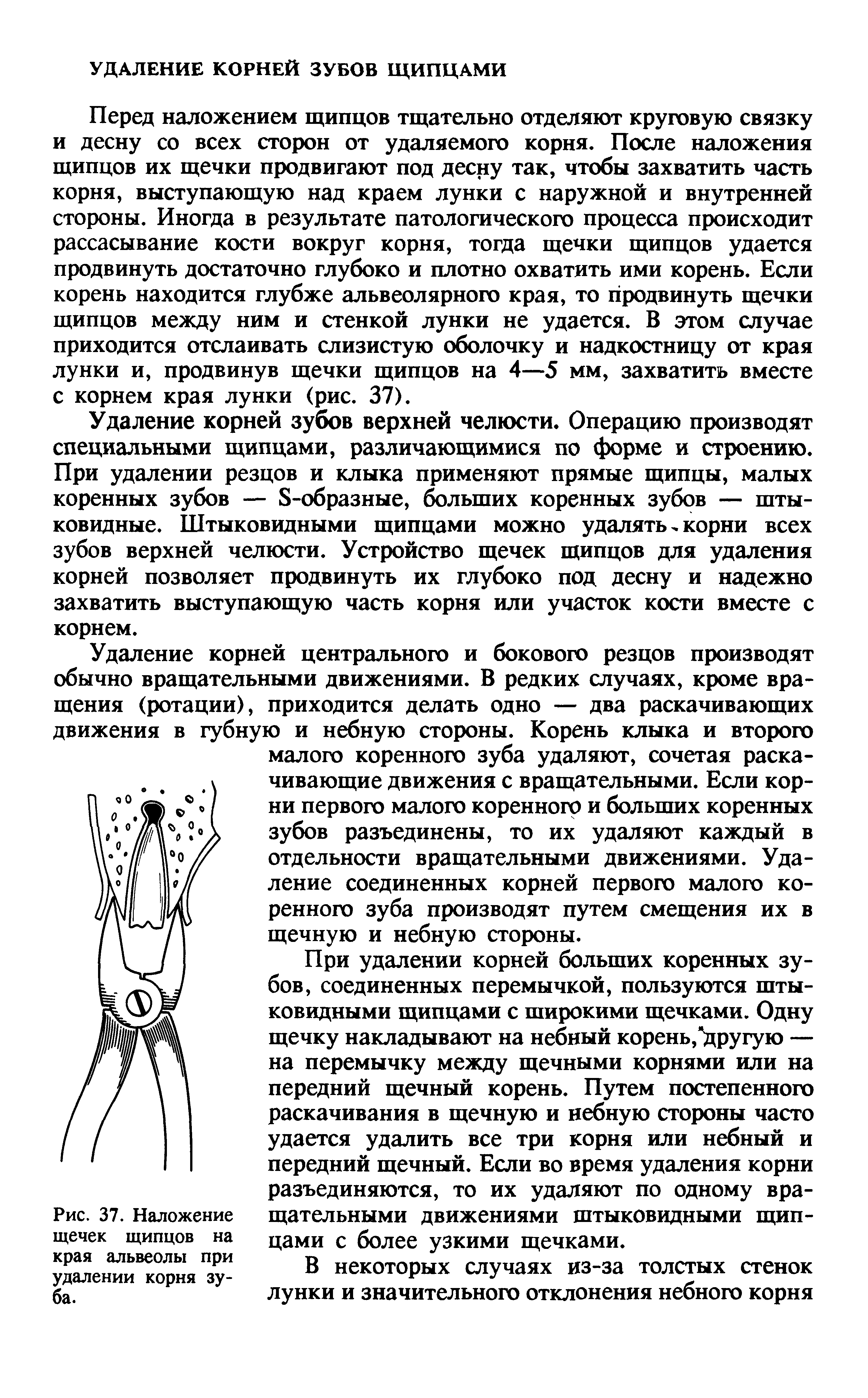 Рис. 37. Наложение щечек щипцов на края альвеолы при удалении корня зуба.