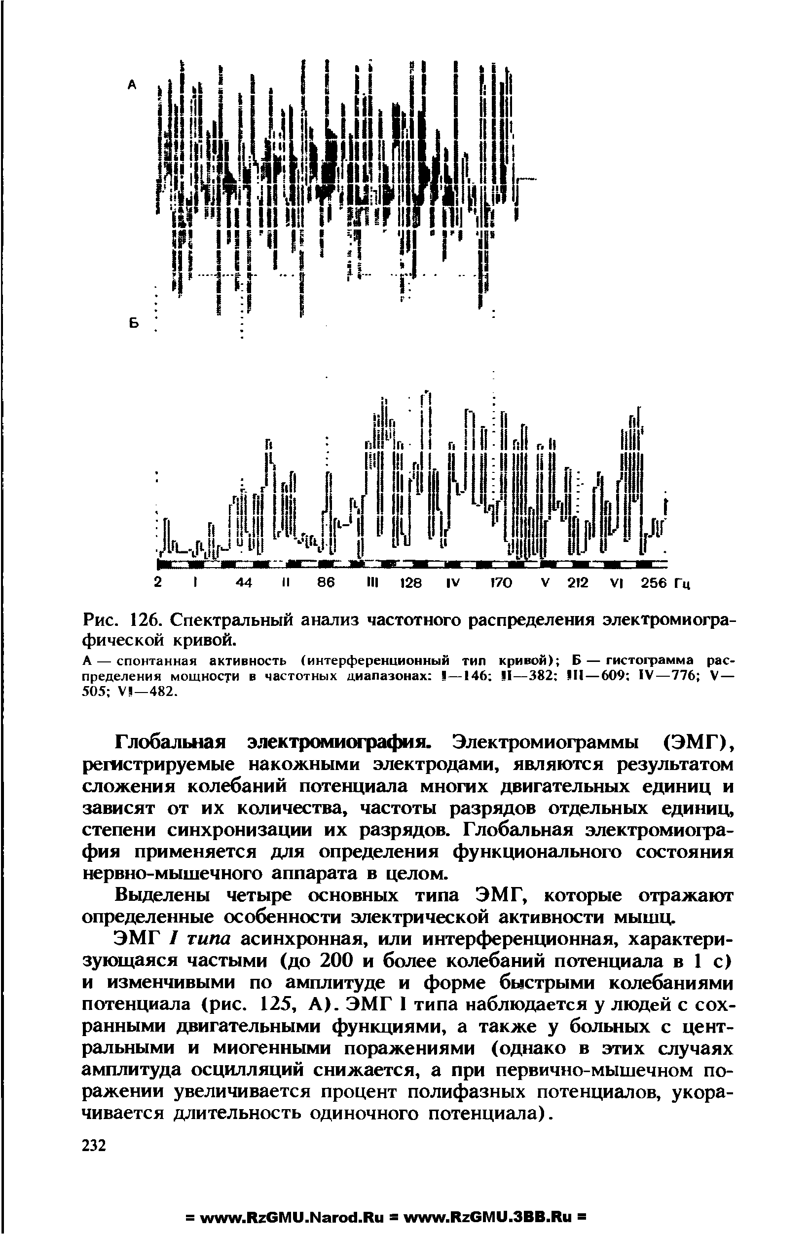 Рис. 126. Спектральный анализ частотного распределения электромиогра-фической кривой.