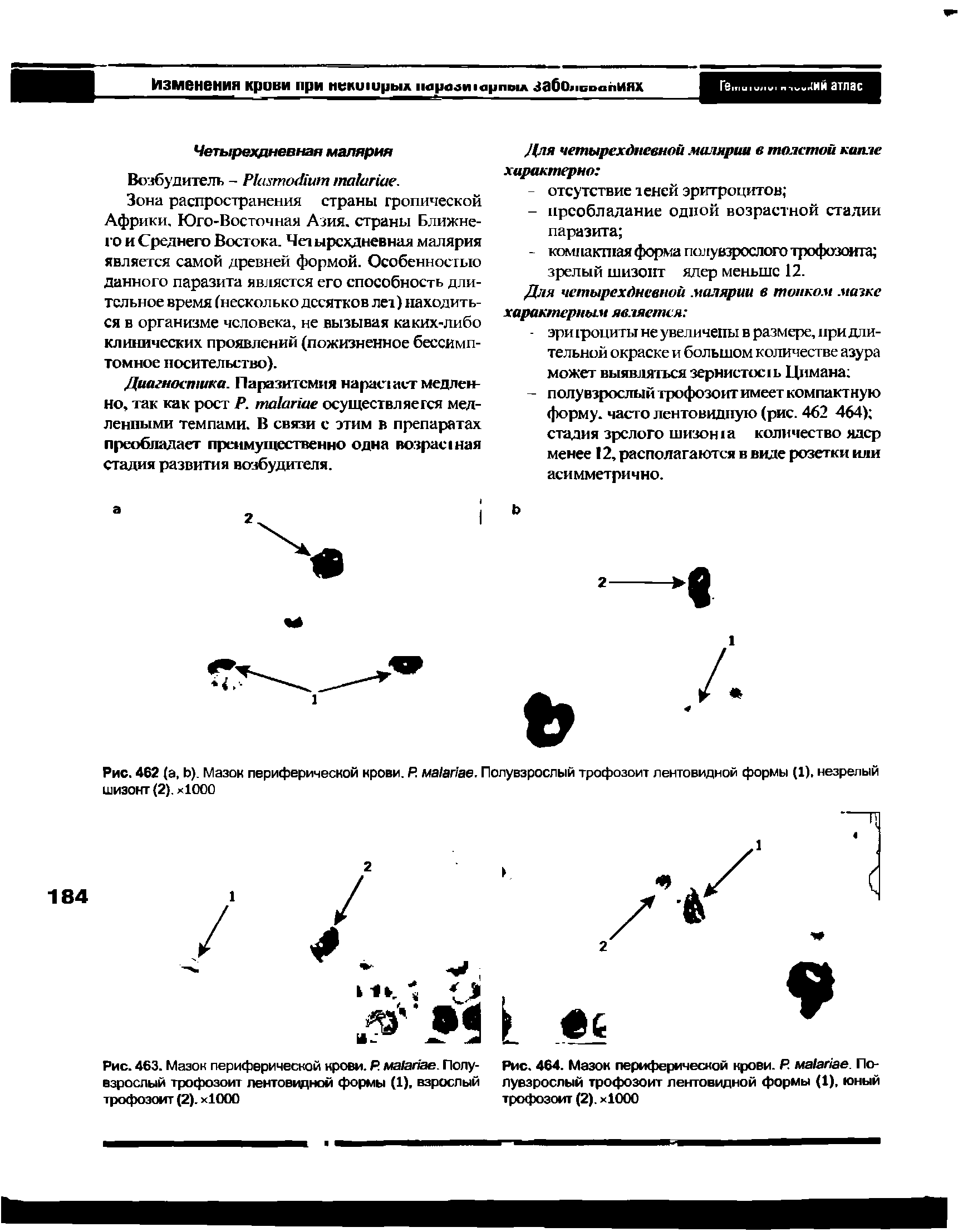 Рис. 463. Мазок периферической крови. Р. ма1апае. Полу- Рис. 464. Мазок периферической крови. Р. ма апае. По-взрослый трофозоит лентовидной формы (1), взрослый лувзрослый трофозоит лентовидной формы (1), юный трофозоит (2). х1000 трофозоит (2). х1000...