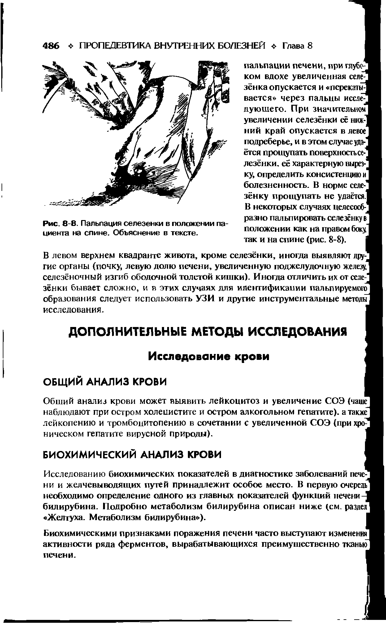 Рис. 8-8. Пальпация селезенки в положении пациента на спине. Объяснение в тексте.