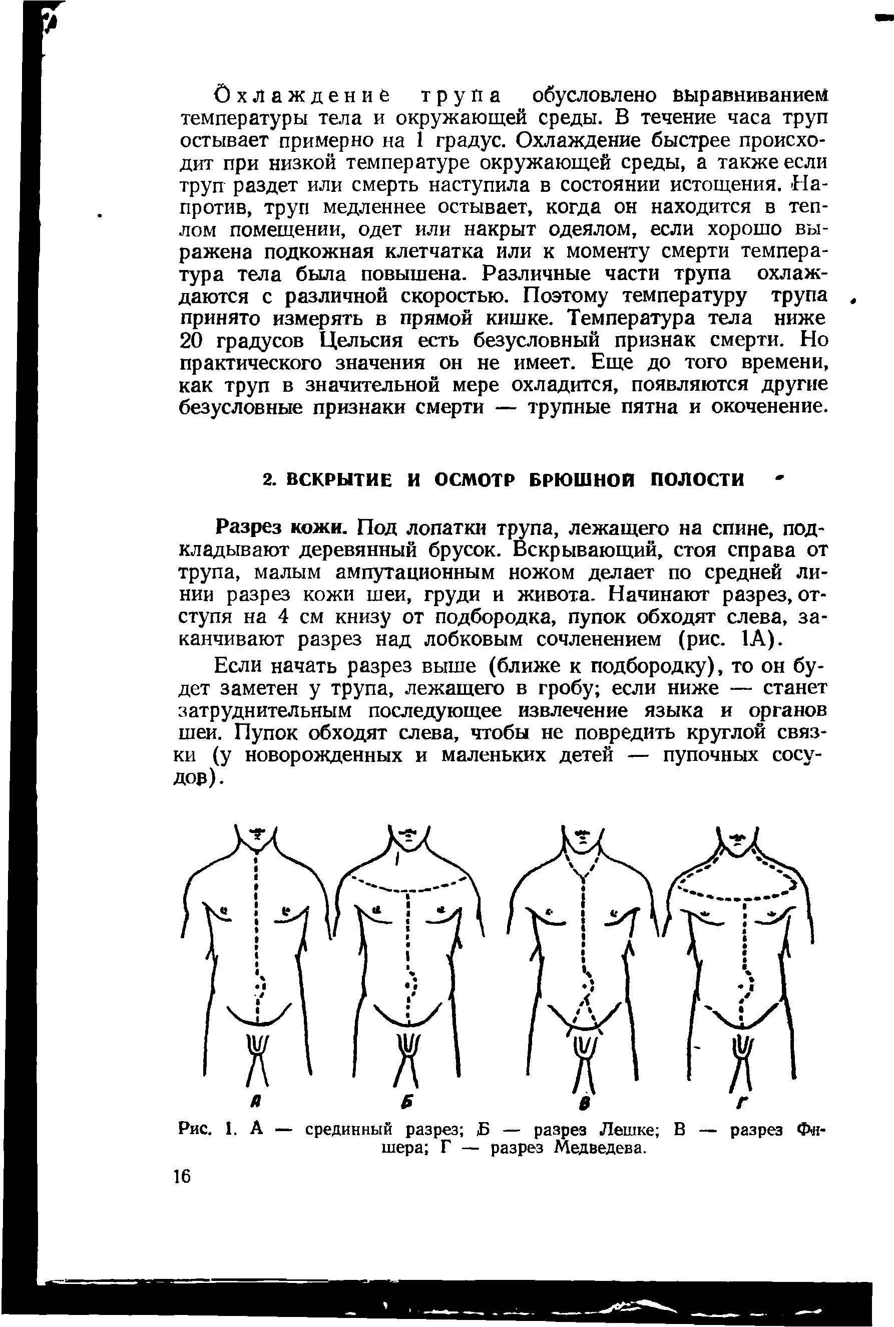 Рис. 1. А — срединный разрез Б — разрез Лешке В — разрез Фишера Г — разрез Медведева.