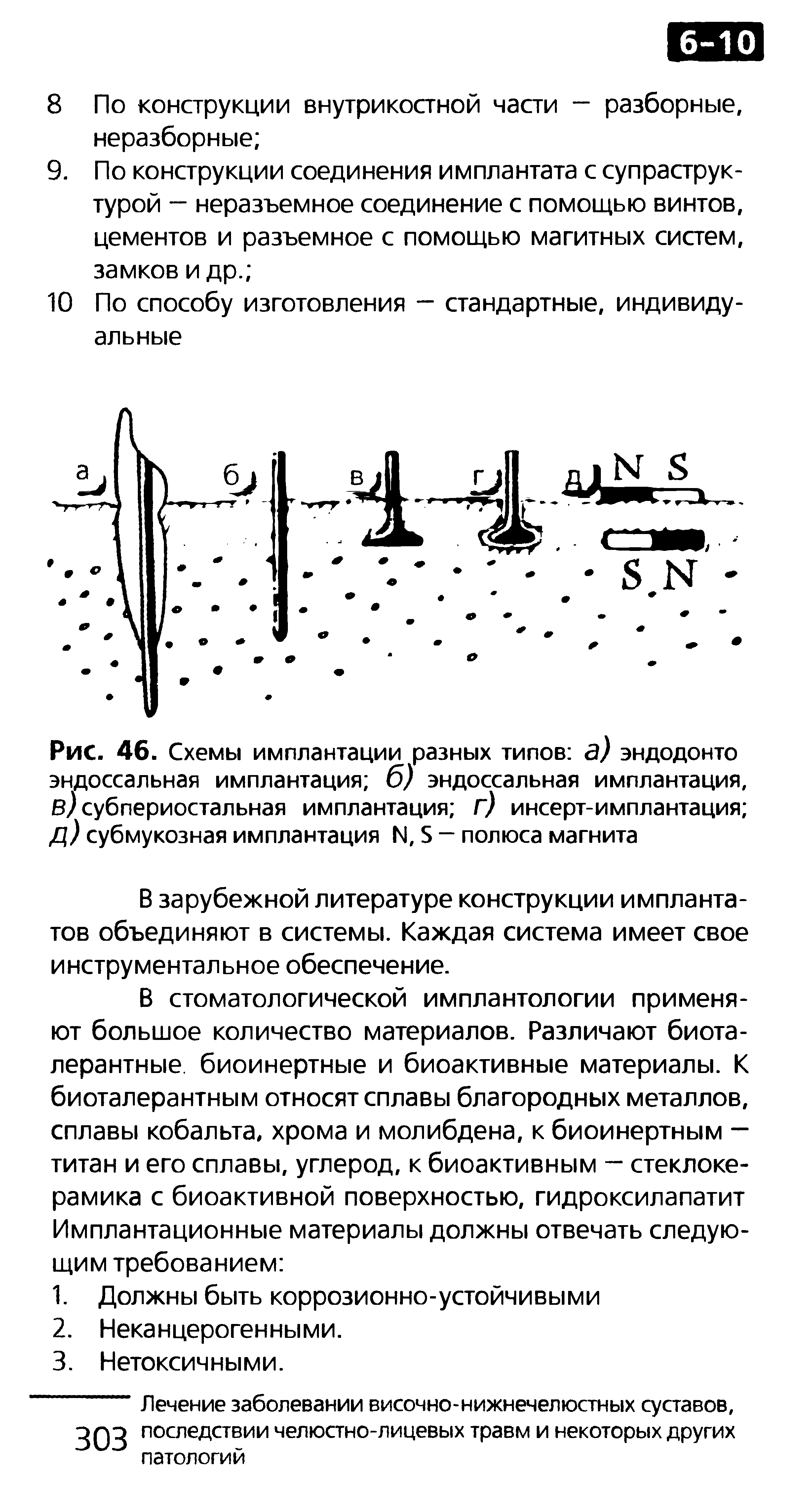 Рис. 46. Схемы имплантации разных типов з) эндодонто эндоссальная имплантация б) эндоссальная имплантация, в) субпериостальная имплантация г) инсерт-имплантация д) субмукозная имплантация 14, Б - полюса магнита...