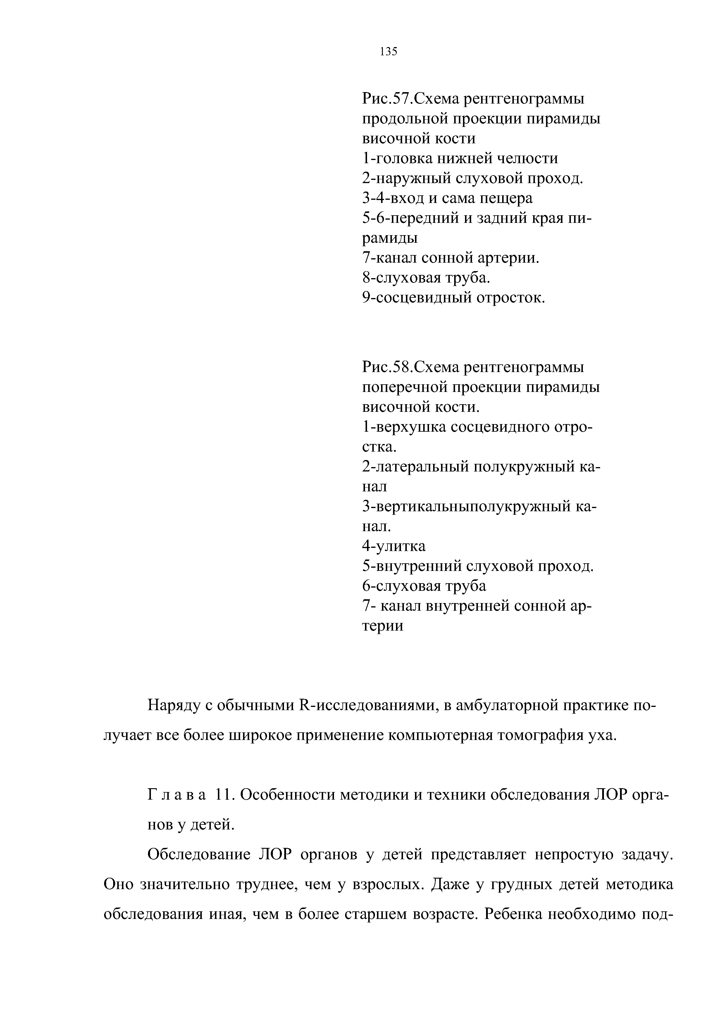 Рис.58.Схема рентгенограммы поперечной проекции пирамиды височной кости.