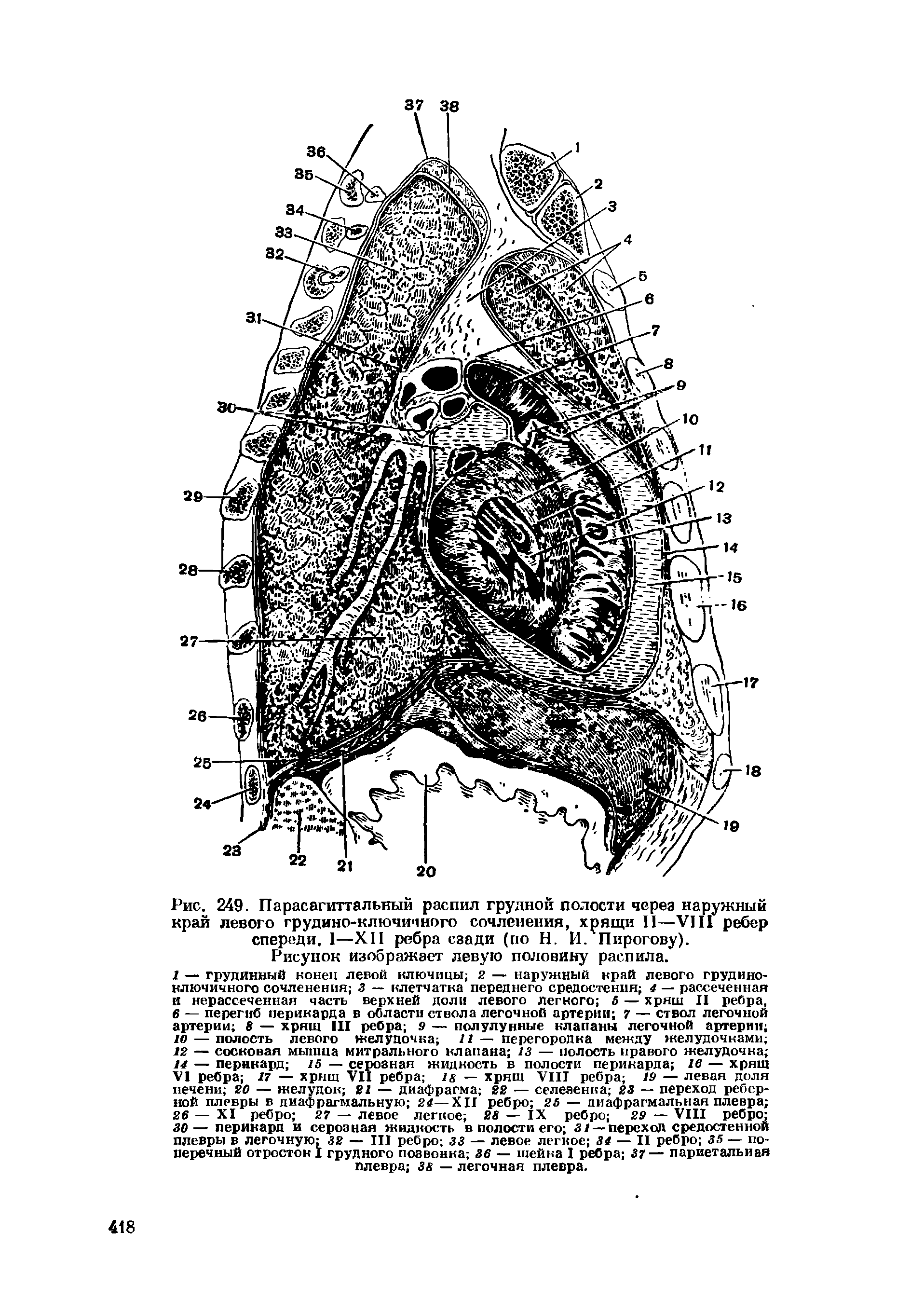 Рис. 249. Парасагиттальный распил грудной полости через наружный край левого грудино-ключичного сочленения, хрящи II—VIII ребер спереди. I—XII ребра сзади (по Н. И. Пирогову). Рисунок изображает левую половину распила.