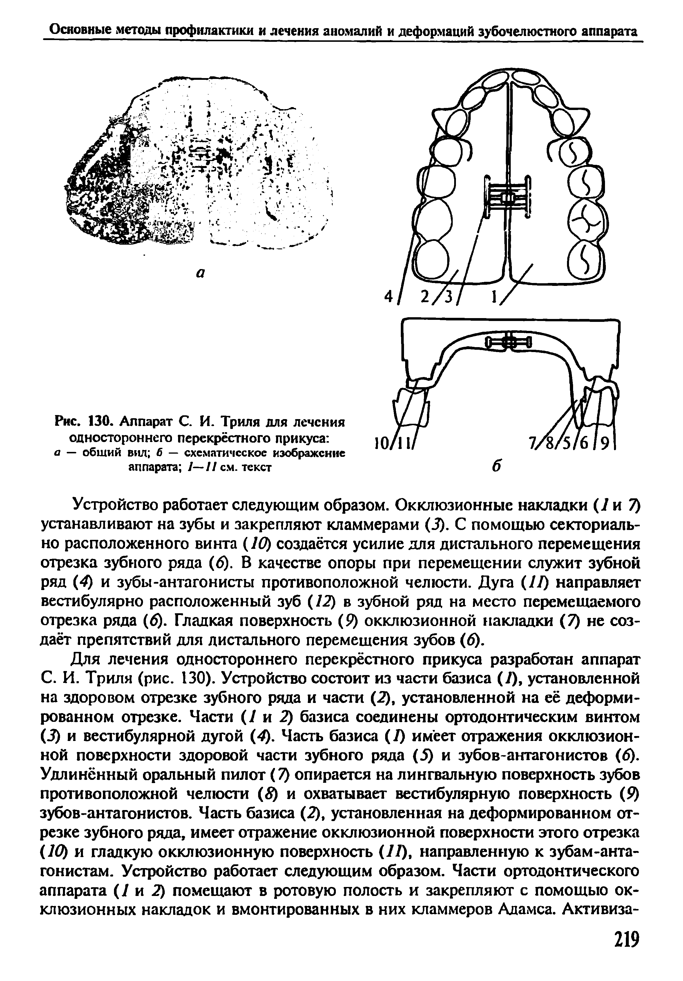 Рис. 130. Аппарат С. И. Триля для лечения одностороннего перекрёстного прикуса а — общий вил б — схематическое изображение аппарата 1—11 см. текст...