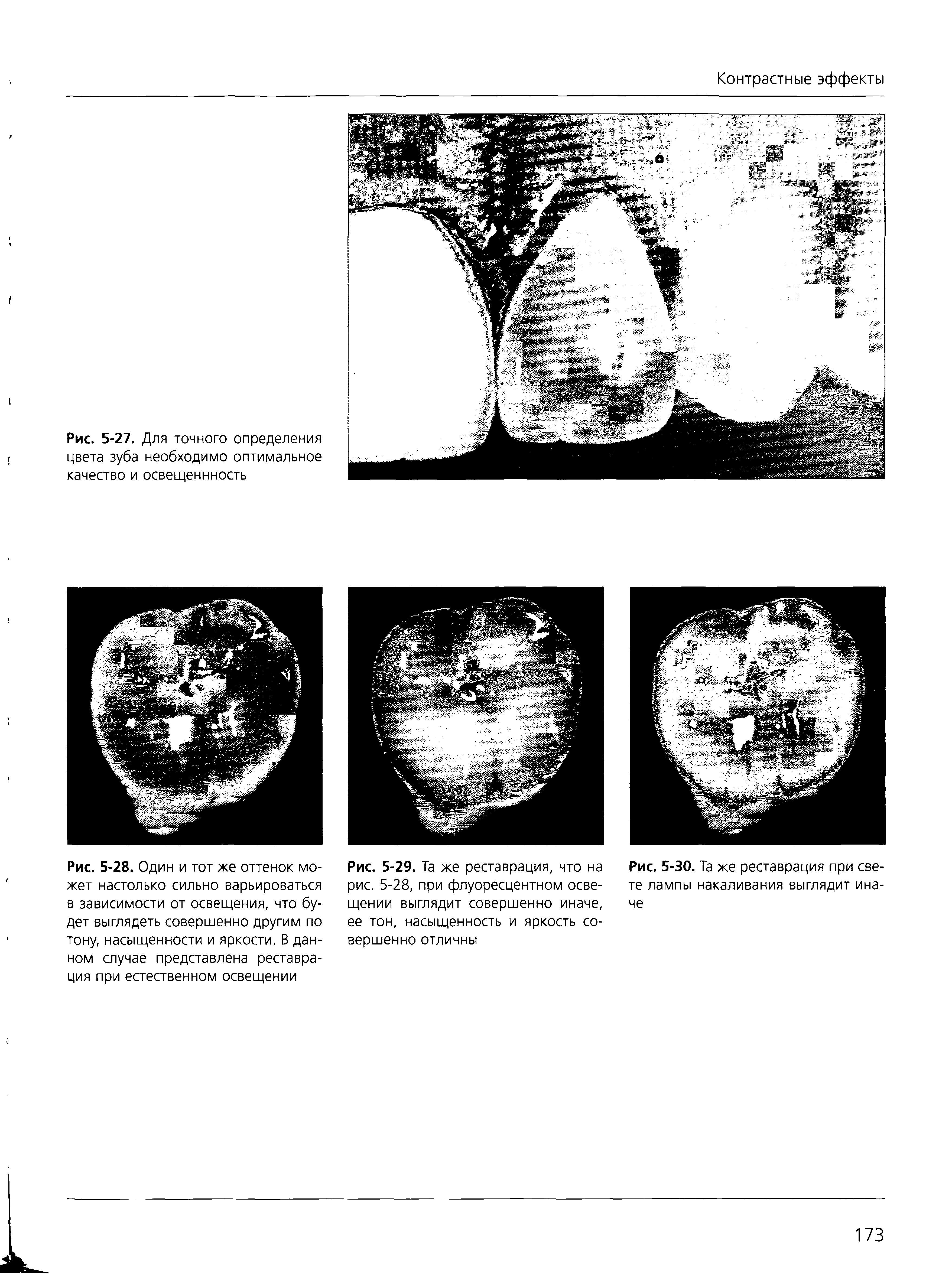 Рис. 5-27. Для точного определения цвета зуба необходимо оптимальное качество и освещеннность...