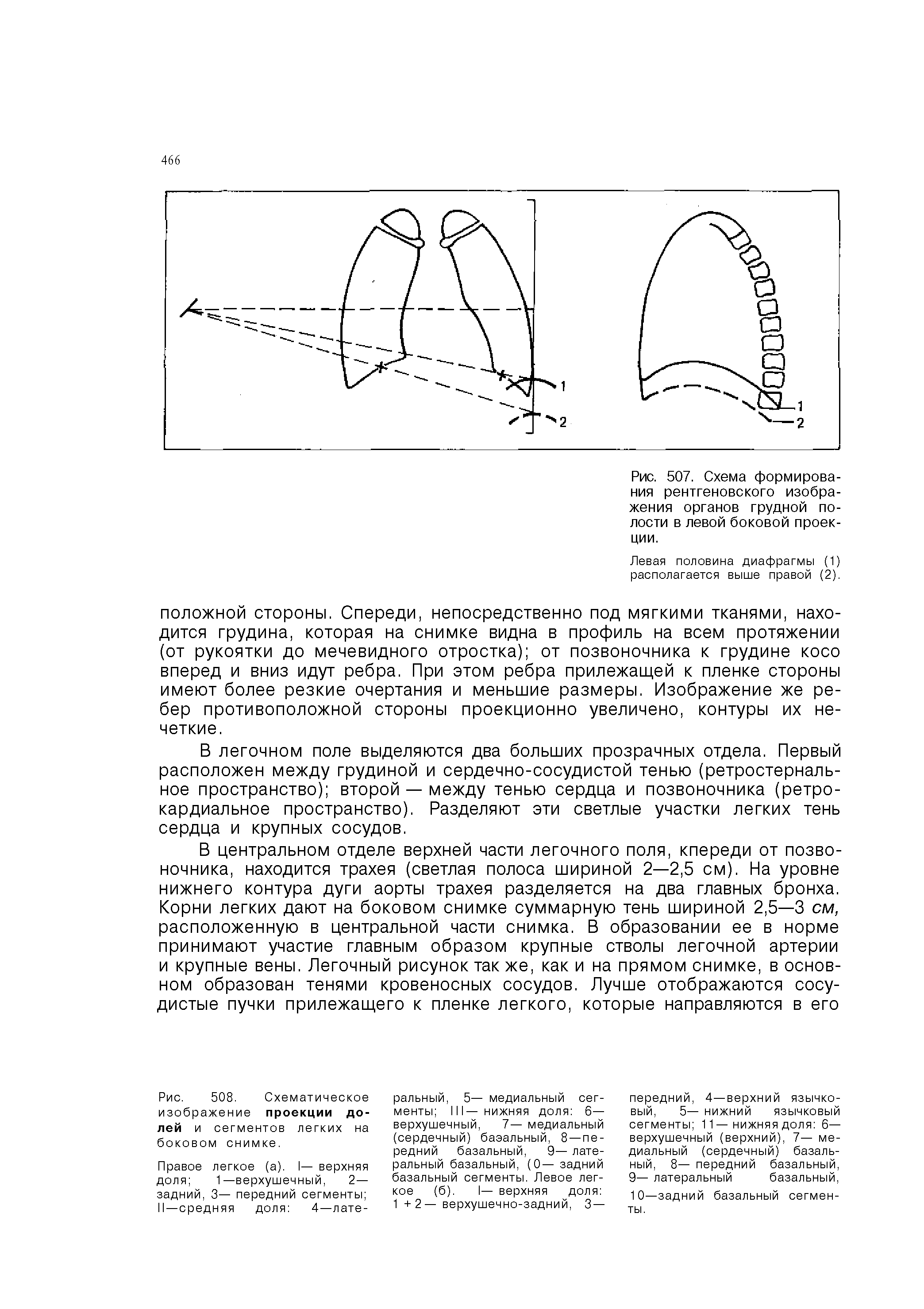 Рис. 507. Схема формирования рентгеновского изображения органов грудной полости в левой боковой проекции.