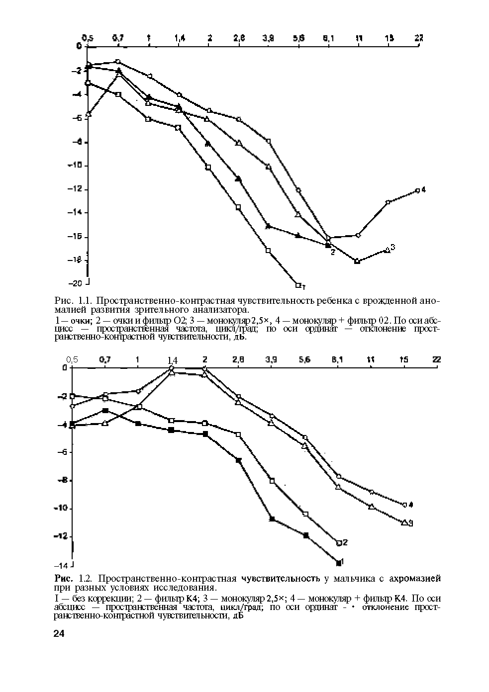 Рис. 1.1. Пространственно-контрастная чувствительность ребенка с врожденной аномалией развития зрительного анализатора.