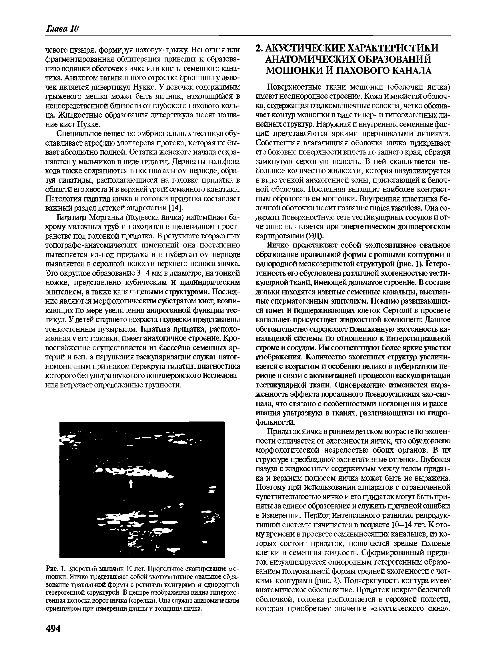 Рис. I. Здоровый мальчик 10 лет. Продольное сканирование мошонки. Яичко представляет собой эхопозптпвное овальное образование правильной формы с ровными контурами и однородной гетерогенной структурой. В центре изображения видна гиперэхогенная полоска ворот яичка (стрелка). Она служит анатомическим...