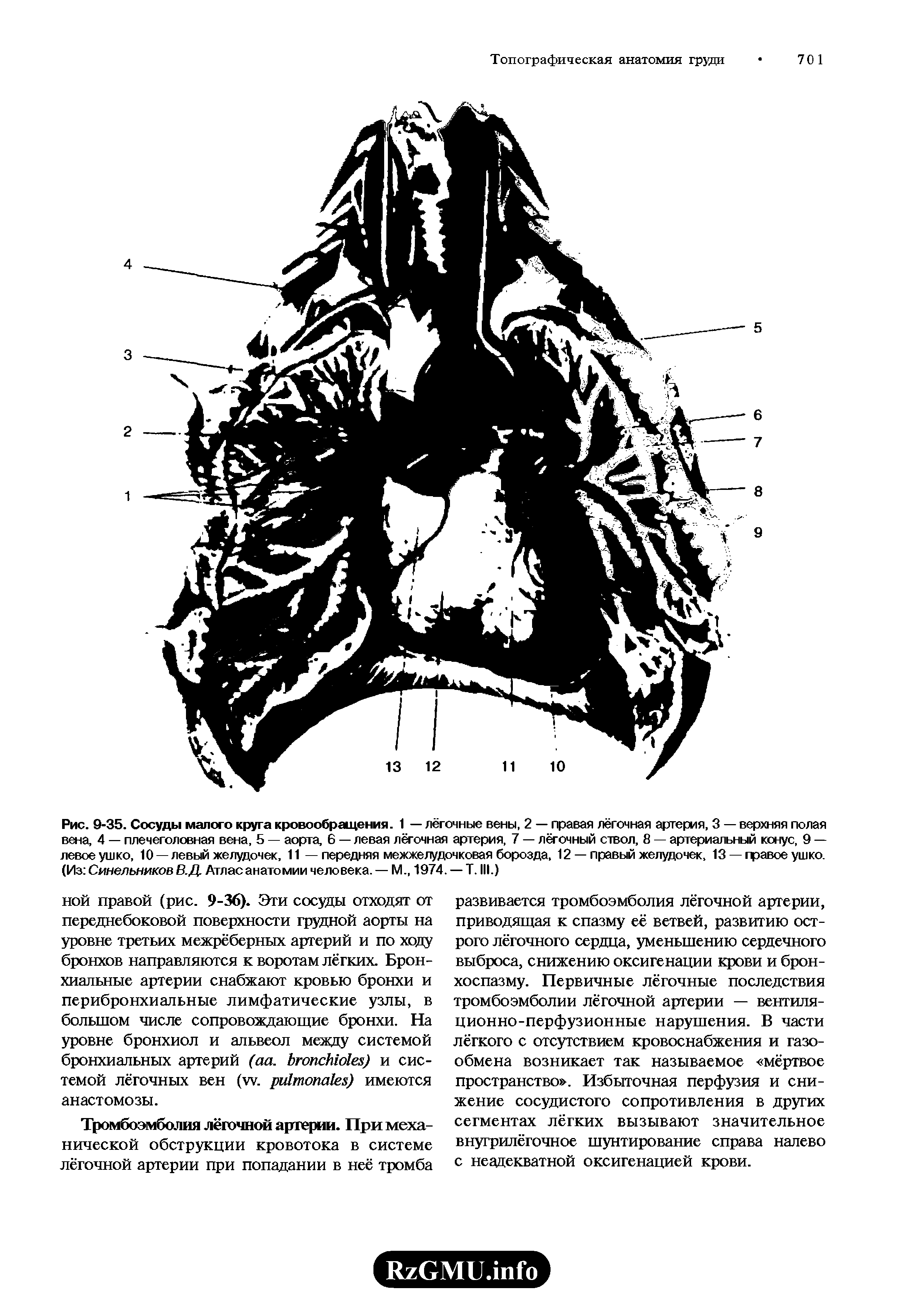 Рис. 9-35. Сосуды малого круга кровообращения. 1 — лёгочные вены, 2 — правая лёгочная артерия, 3 — верхняя полая вена, 4 — плечеголовная вена, 5 — аорта, 6 — левая лёгочная артерия, 7 — лёгочный ствол, 8 — артериальный конус, 9 — левоеушко, 10 —левый желудочек, 11 — передняя межжелудочковая борозда, 12 —правый желудочек, 13 — гравое ушко. (Из Синельников В.Д. Атлас анатомии человека. — М., 1974. — Т. III.)...